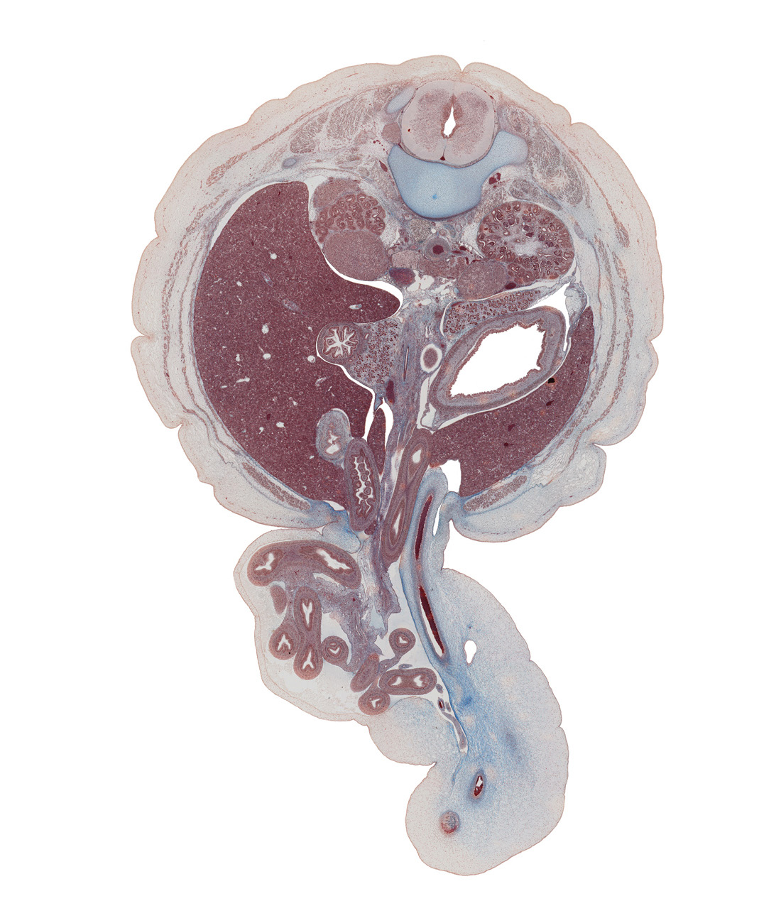 T-12 / L-1 interganglion region, allantoic vesicle(s), aorta, body of dorsal pancreas, colon, descending part of duodenum, edge of ascending part of duodenum, edge of right umbilical artery, gall bladder, greater curvature of stomach, head of ventral pancreas, herniated intestines, inferior vena cava, jejunum, kidney (metanephros), left lobe of liver, left umbilical artery, lesser sac (omental bursa), midpoint of midgut (ileum), notochord, right lobe of liver, superior mesenteric artery, superior mesenteric vein, superior pole of kidney (metanephros), sympathetic trunk, umbilical coelom, umbilical cord, umbilical vein, umbilical vesicle stalk