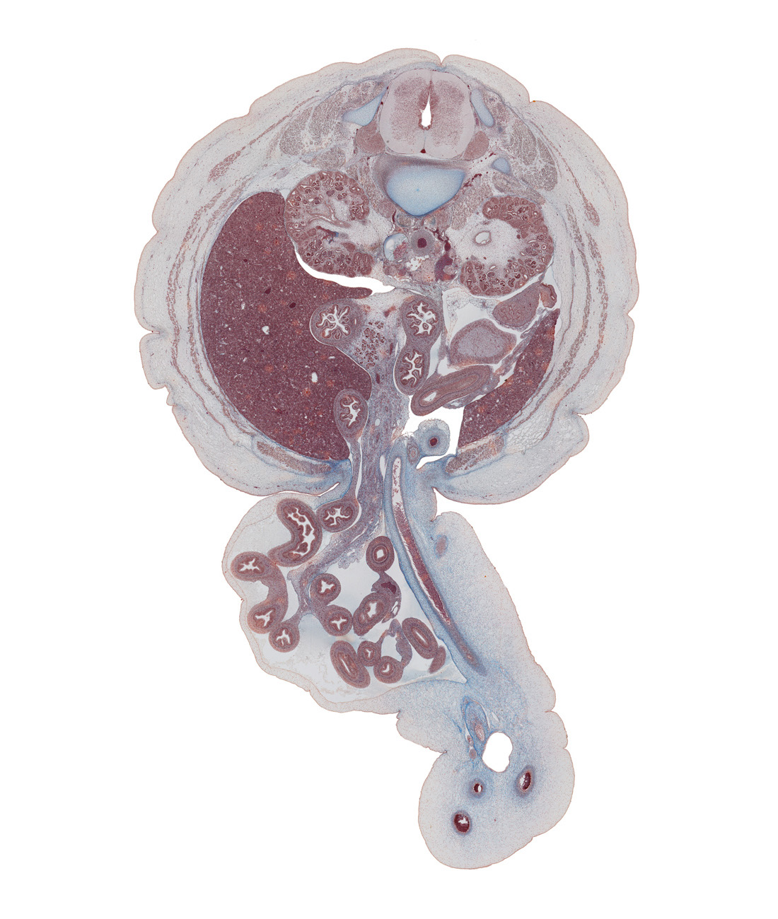 L-1 spinal ganglion, allantoic vesicle(s), aorta, ascending part of duodenum, cephalic edge of testis, colon, descending part of duodenum, extension of umbilical coelom, herniated intestines, hilum of kidney (metanephros), ileocecal junction, iliocostalis muscle, inferior vena cava, jejunum, lateral border of kidney (metanephros), left umbilical artery, longissimus muscle, medial border of kidney (metanephros), mesocolon, minor calyx, pancreatic duct, renal pelvis, right umbilical artery, superior mesenteric artery, transversospinalis muscle, umbilical vein, umbilical vesicle stalk, uncinate process of ventral pancreas