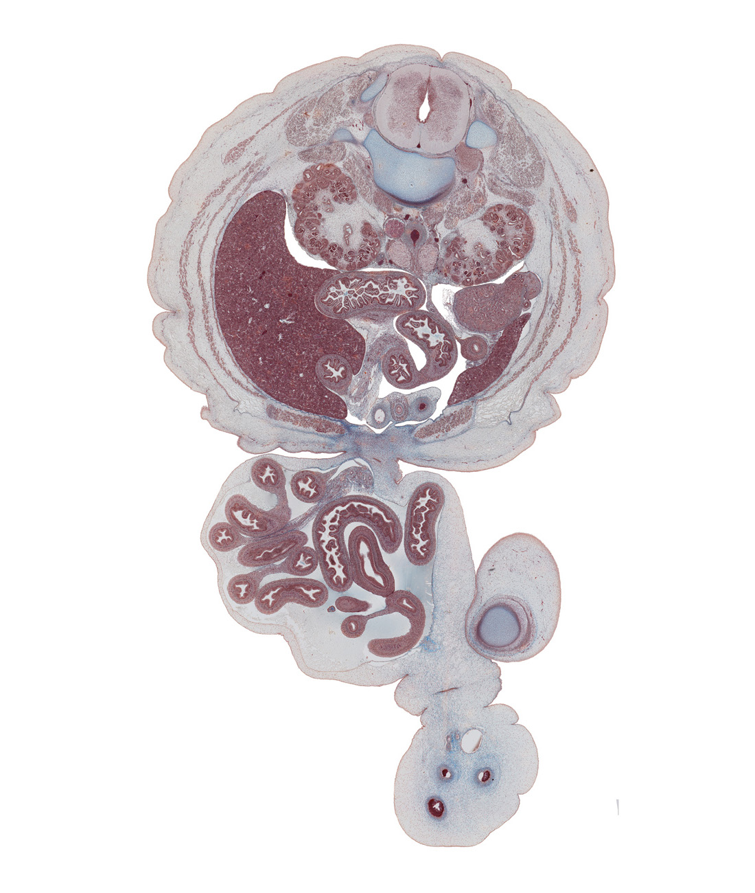 L-2 spinal ganglion, allantoic vesicle(s), aorta, caudal edge of appendix, cecum, colon, hilum of kidney (metanephros), horizontal part of duodenum, inferior mesenteric ganglion, inferior vena cava, jejunum, kidney impression of liver, left lobe of liver, left umbilical artery, medial condyle of femur, medial edge of patella, mesentery, origin of inferior mesenteric artery, right lobe of liver, right umbilical artery, testis, umbilical vein, ureter