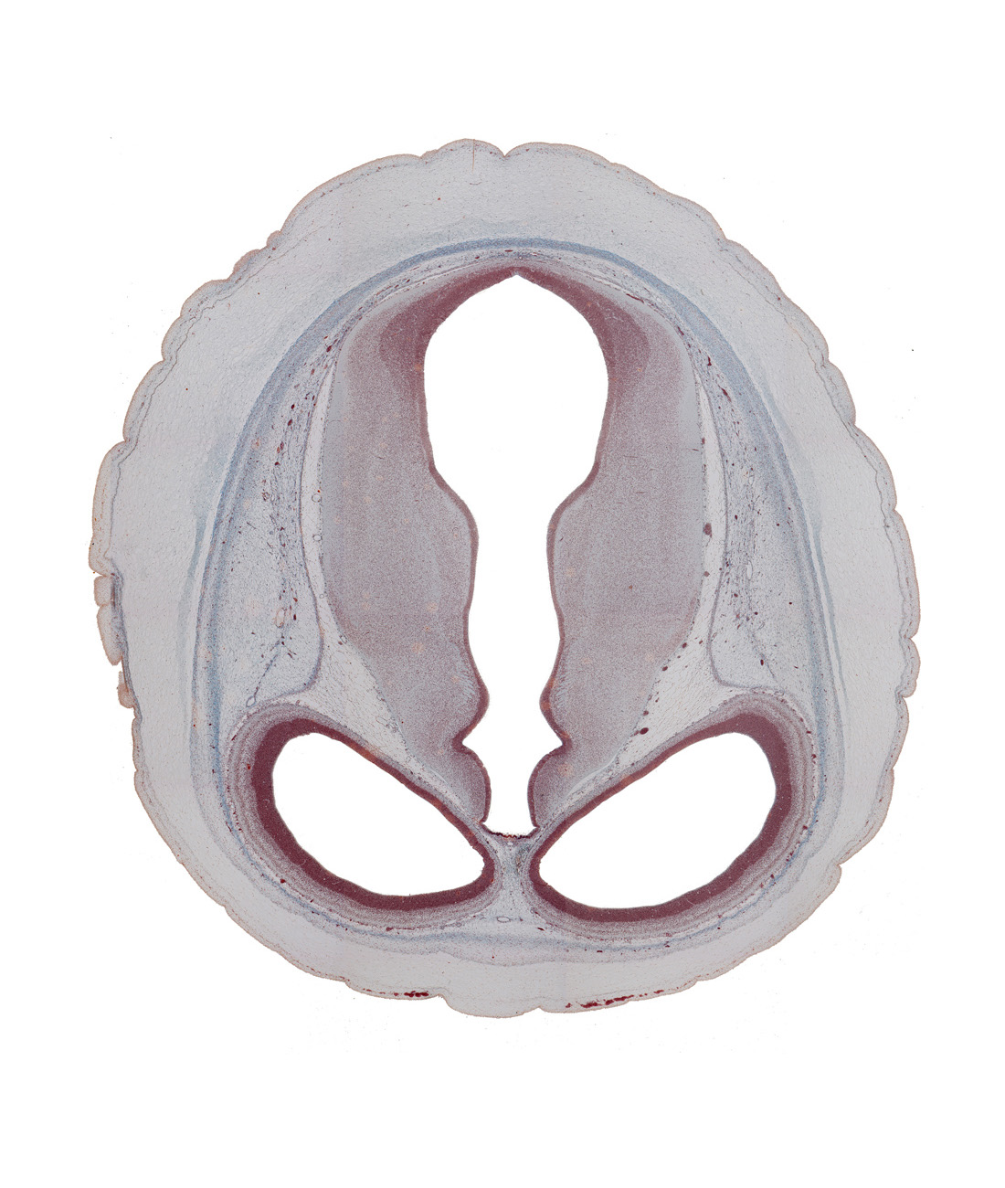 cerebral aqueduct (mesocoele), cerebral hemisphere (neopallium), collicular ridge (tectum), diencephalon, dorsal thalamus (caudal part), dural limiting membrane, ectomeninx, endomeninx, habenular region, hypothalamic sulcus, junction of cerebral aqueduct and third ventricle, lateral ventricle, mesencephalon, osteogenic layer, subarachnoid space, third ventricle