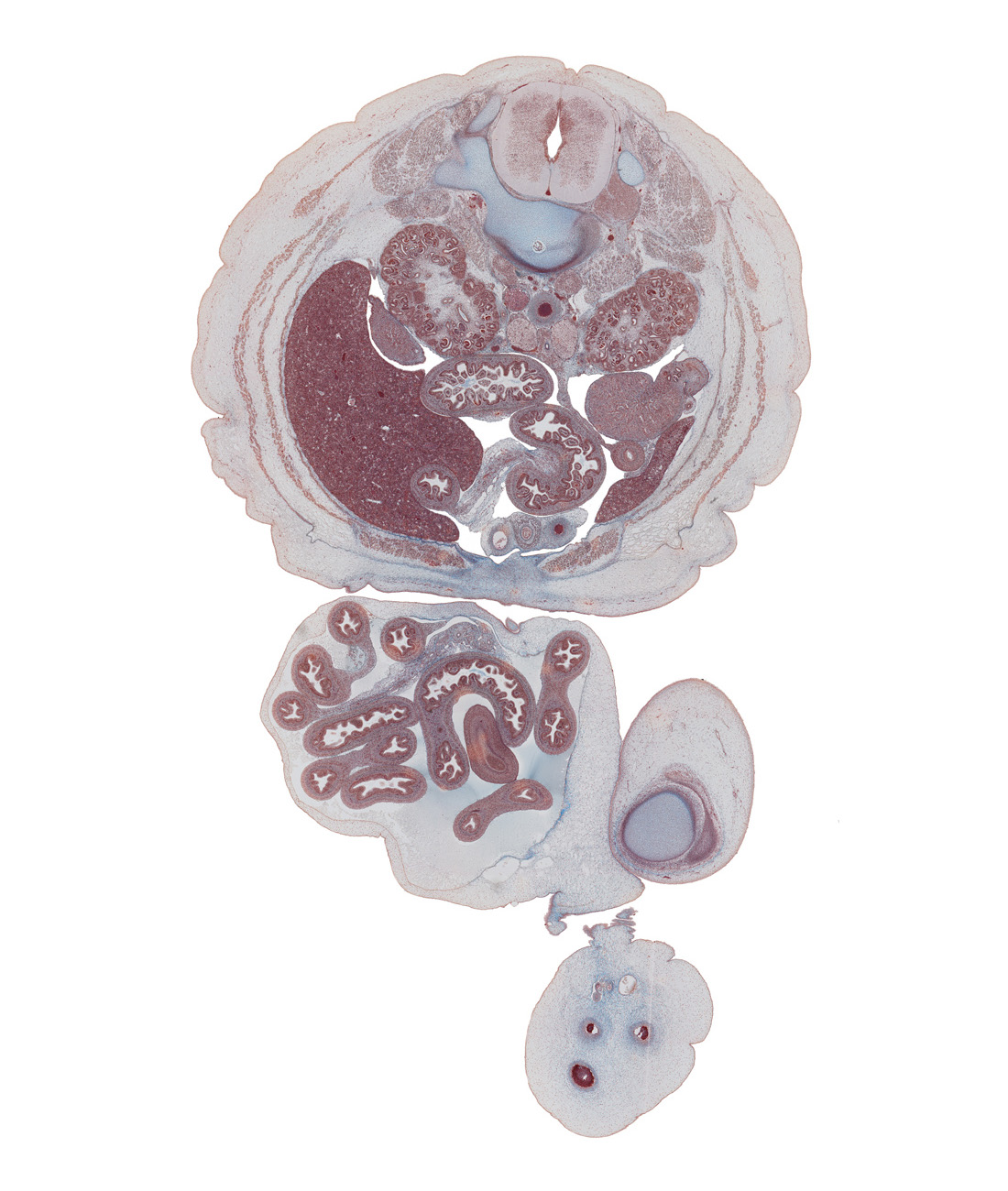 L-2 spinal ganglion, allantoic vesicle(s), aorta, fundus of urinary bladder, horizontal part of duodenum, inferior mesenteric artery, inferior mesenteric ganglion, inferior vena cava, jejunum, left lobe of liver, left umbilical artery, medial condyle of femur, medial part of patella, mesentery, quadriceps femoris tendon, renal cortex, right umbilical artery, small intestines, testis, umbilical cord, umbilical vein, umbilical vesicle stalk, vas deferens (mesonephric duct)