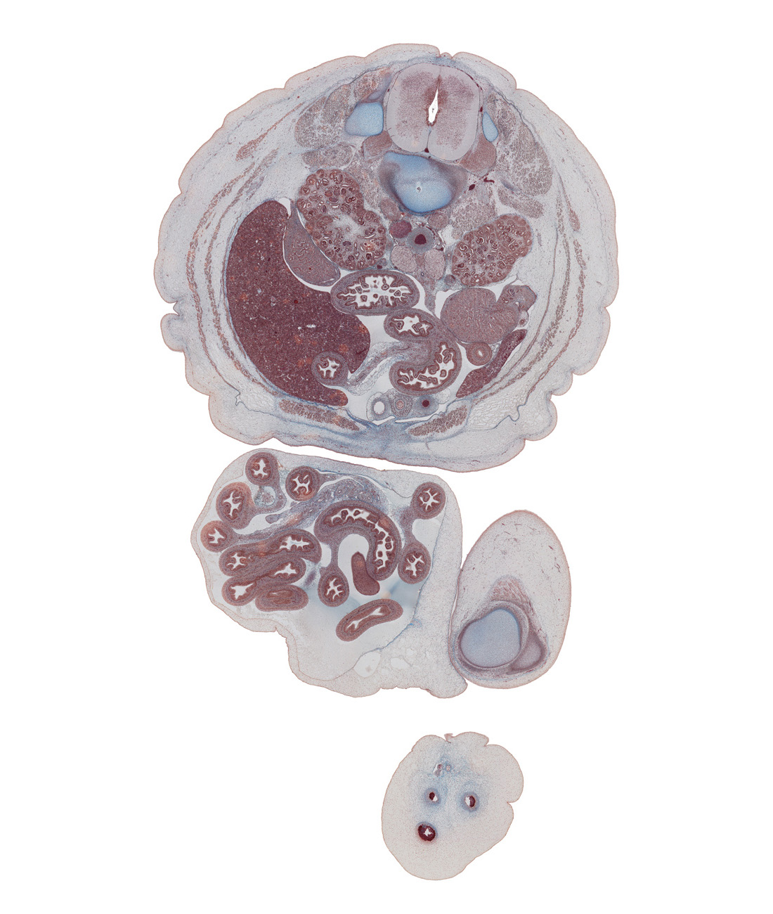 L-2 spinal ganglion, aorta, colon, external abdominal oblique muscle, horizontal part of duodenum, inferior vena cava, internal abdominal oblique muscle, jejunum, lateral border of kidney (metanephros), left umbilical artery, linea alba, medial condyle of femur, mesentery, mesocolon, notochord, para-aortic ganglion, patella, quadriceps femoris muscle, rectus abdominis muscle, rectus sheath, right lobe of liver, right umbilical artery, sympathetic trunk, testis, transversus abdominis muscle, umbilical cord, umbilical vein, umbilical vesicle stalk, ureter, vas deferens