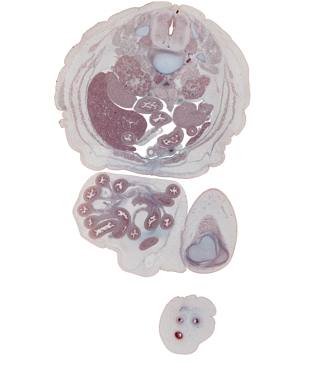 L-2 / L-3 intervertebral disc, L-2 spinal ganglion, aortic bifurcation, colon, epididymis, fundus of urinary bladder, herniated intestines, horizontal part of duodenum, inferior mesenteric artery, inferior mesenteric ganglion, inferior vena cava, jejunum, left lobe of liver, left umbilical artery, medial condyle of femur, minor calyx, notochord, patella, quadratus lumborum muscle, quadriceps femoris muscle, quadriceps femoris tendon, right lobe of liver, right umbilical artery, sympathetic trunk, testis, umbilical cord, umbilical vein, umbilical vesicle stalk, ureter, vas deferens