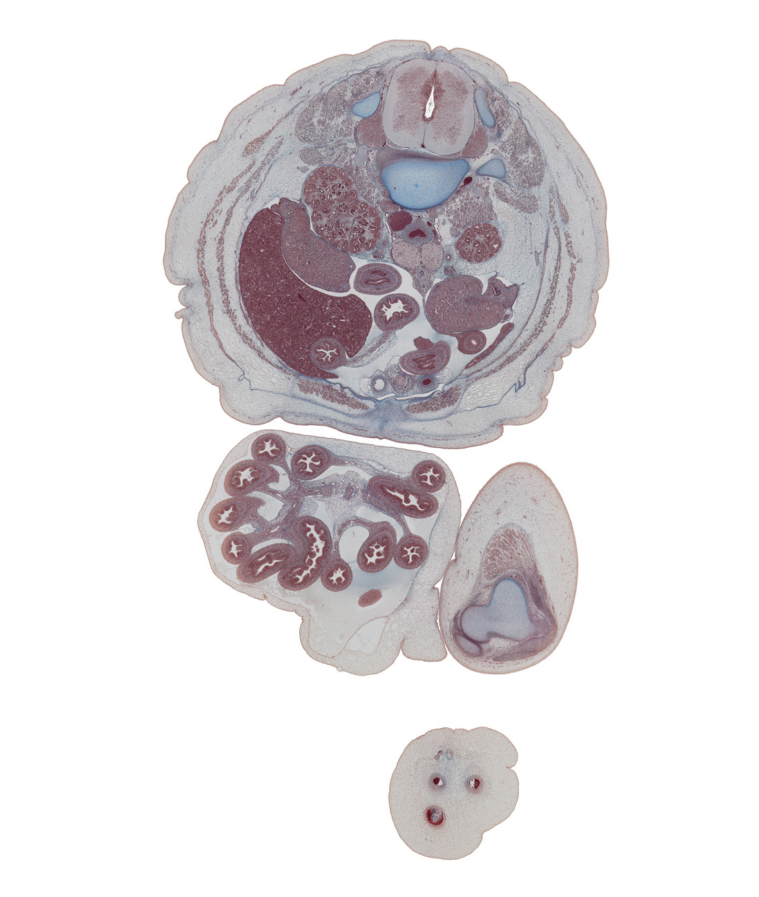 L-2 spinal ganglion, aortic bifurcation, caudal edge of horizontal part of duodenum, caudal edge of jejunum loop, caudal edge of left lobe of liver, colon, epididymis, femur, fundus of urinary bladder, inferior pole of kidney (metanephros), inferior vena cava, jejunum, lateral border of kidney (metanephros), left umbilical artery, mesentery with superior mesenteric vessels, mesocolon, quadriceps femoris muscle, right lobe of liver, right umbilical artery, superior edge of tibia, suprarenal gland, sympathetic trunk, testis, umbilical coelom, umbilical cord, umbilical vein, vas deferens