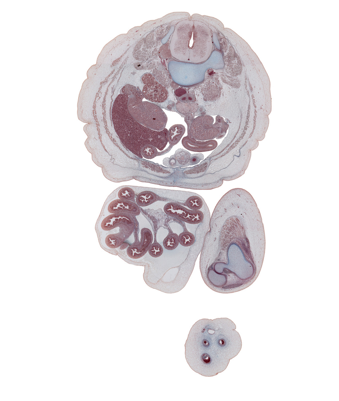 L-2 / L-3 interganglion region, allantoic vesicle(s), anterior rectus sheath, colon, fundus of urinary bladder, hypogastric ganglion, iliocostalis muscle, inferior vena cava, left common iliac artery, left umbilical artery, longissimus muscle, medial condyle of tibia, mesentery, posterior rectus sheath, quadratus lumborum muscle, quadriceps femoris muscle, rectus abdominis muscle, right common iliac artery, right testis, right umbilical artery, superior mesenteric vessels, sympathetic trunk, testis, tibia, transversospinalis muscle, umbilical vein, umbilical vesicle stalk, vas deferens