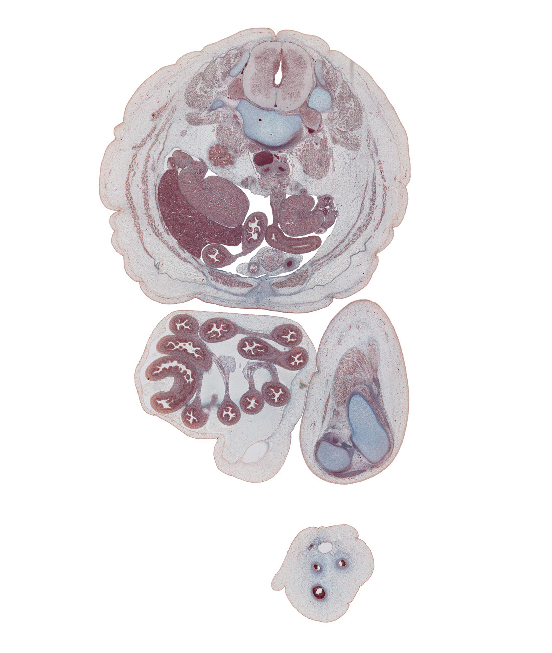 L-3 spinal ganglion, allantoic vein, amnion, colon, edge of sartorius muscle, epididymis, femur, fundus of urinary bladder, inferior pole of kidney (metanephros), inferior vena cava, jejunum, left common iliac artery, left umbilical artery, linea alba, mesentery, mesocolon, mucoid connective tissue, patellar ligament, peritoneal cavity, psoas major muscle, quadriceps femoris muscle, rete testis, right testis, right umbilical artery, superior mesenteric vessels, sympathetic trunk, tibia, umbilical vein, umbilical vesicle stalk, vas deferens