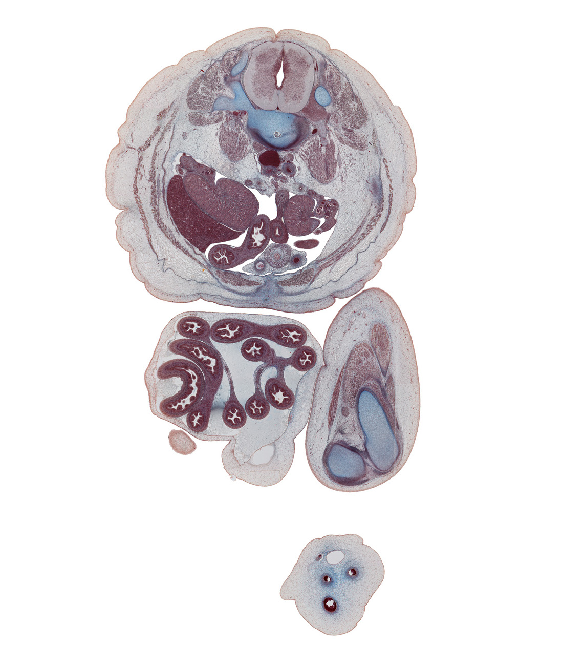 L-3 spinal ganglion, L-3 spinal nerve, allantoic vein, amnion, anterior rectus sheath, aponeurosis, colon, edge of ilium, edge of right knee, extension of umbilical coelom, external abdominal oblique muscle, femur, inferior vena cava, internal abdominal oblique muscle, left common iliac artery, left umbilical artery, mesentery, mesocolon, quadratus lumborum muscle, rectus abdominis muscle, rectus femoris muscle, rete testis, right umbilical artery, sartorius muscle, testicular cords, tibia, transversus abdominis muscle, umbilical coelom, umbilical cord, umbilical vein, umbilical vesicle stalk, urinary bladder, vas deferens, vastus intermedius muscle, ventral root