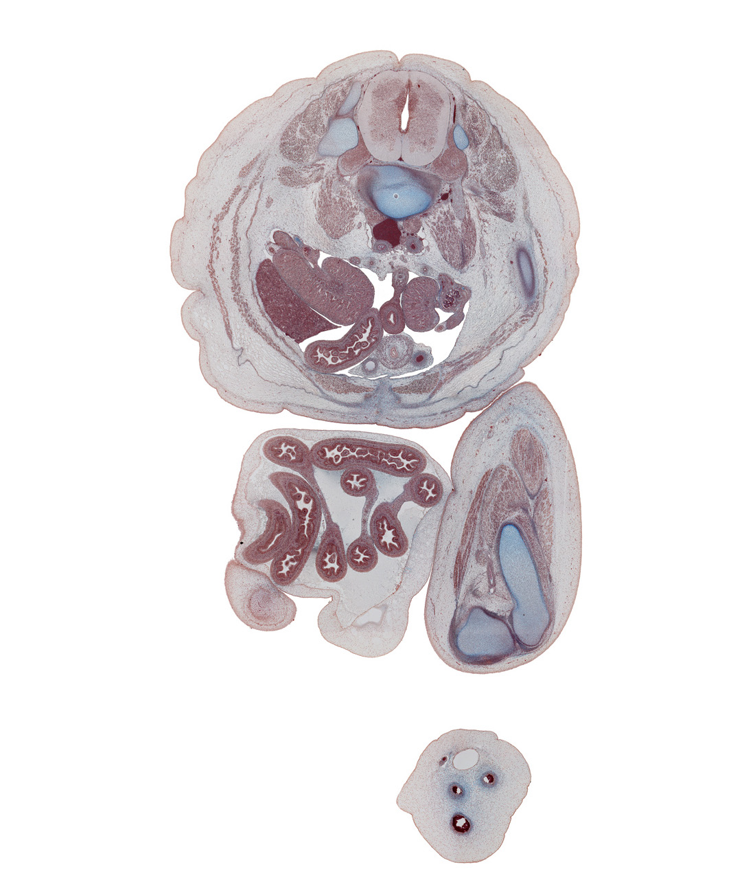 L-3 spinal ganglion, L-3 spinal nerve, anterior rectus sheath, colon, femur, herniated intestines, iliocostalis muscle, ilium, inferior vena cava, jejunum, knee joint, left common iliac artery, left umbilical artery, longissimus muscle, medial condyle of tibia, mesocolon, multifidus muscle, notochord, popliteal artery, psoas major muscle, rectus abdominis muscle, rectus femoris muscle, rete testis, right common iliac artery, right knee, sartorius muscle, sympathetic trunk, testicular cords, tunica albuginea, umbilical coelom, umbilical cord, vas deferens, vastus lateralis muscle