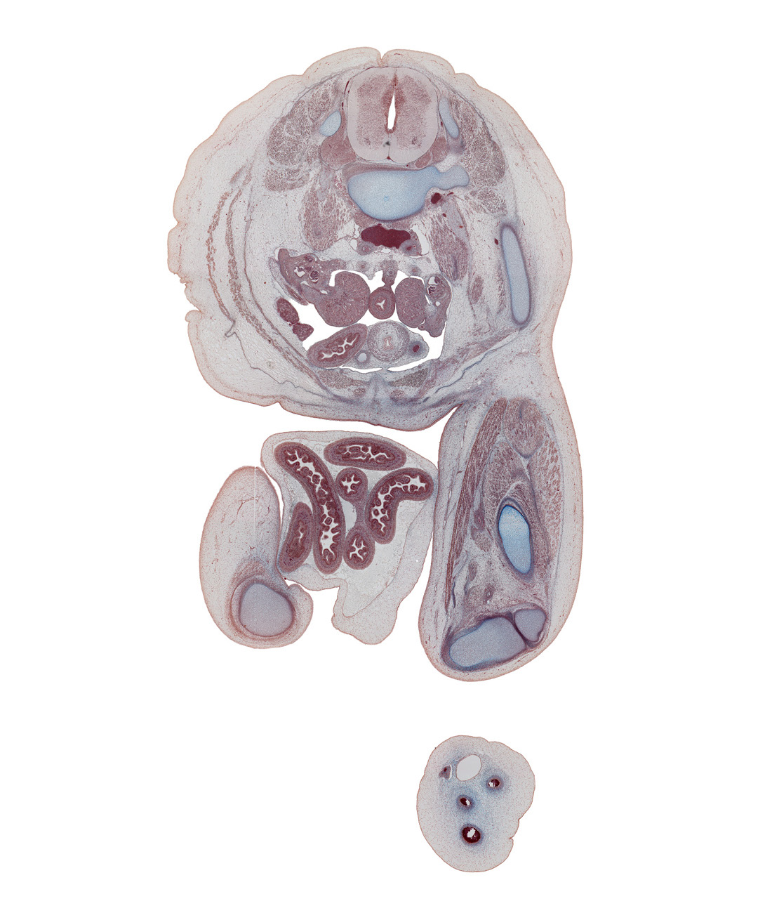 L-3 spinal ganglion, caudal edge of right lobe of liver, colon, external abdominal aponeurosis, femoral nerve, femur, great saphenous vein, herniated intestines, ilium, jejunum, junction of common iliac veins, knee joint, lateral condyle of femur, left common iliac artery, left umbilical artery, linea alba, medial condyle of tibia, peritoneal cavity, popliteal artery, popliteal fossa, psoas major muscle, pyramidalis muscle, rectus abdominis muscle, right common iliac artery, sartorius muscle, semimembranosus muscle, semitendinosus tendon, sympathetic trunk, testis, umbilical coelom, umbilical cord, ureter, vas deferens