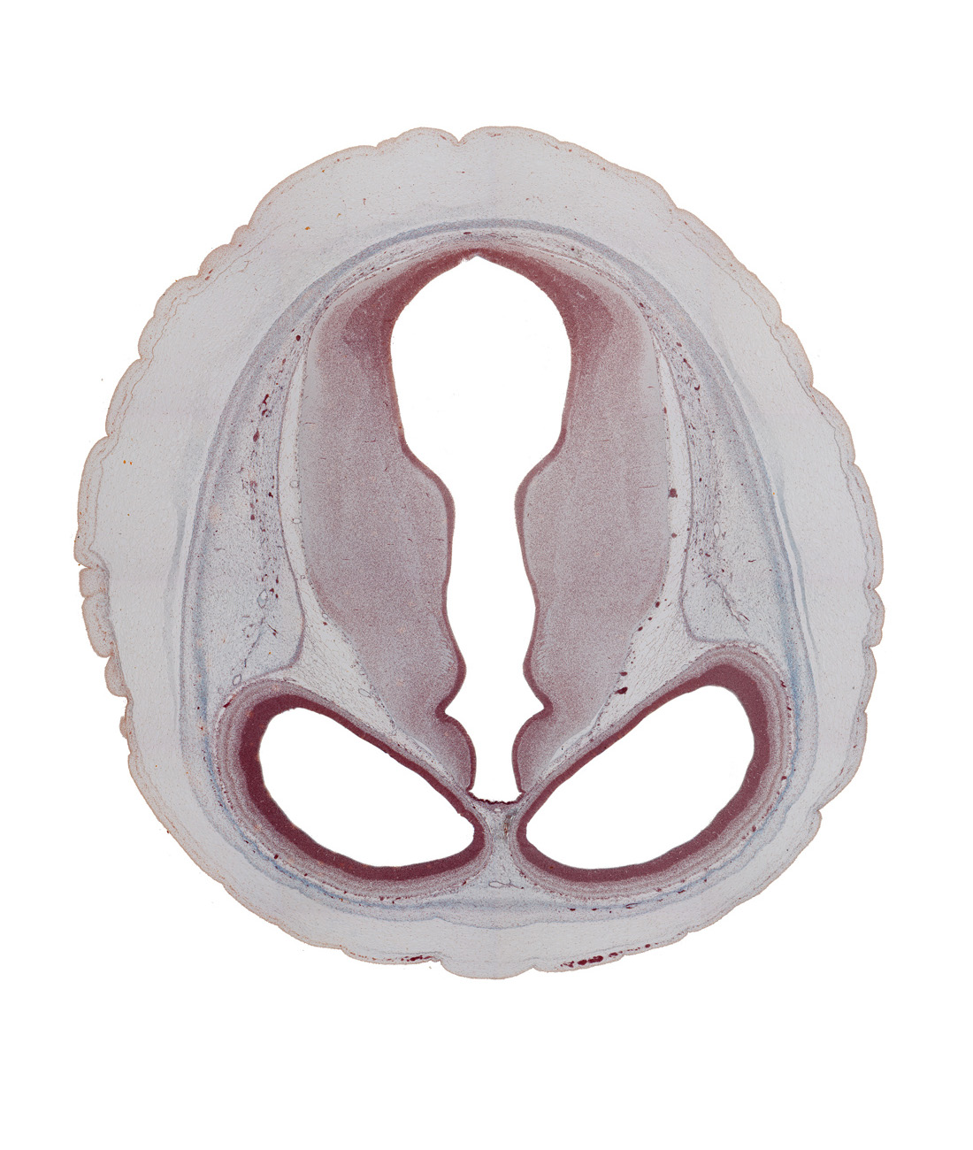 cerebral aqueduct (mesocoele), diencephalon, dorsal thalamus, hypothalamic sulcus, junction of cerebral aqueduct and third ventricle, lateral ventricle, mesencephalon (tectum), mesencephalon (tegmentum), sulcus dorsalis, third ventricle, venous plexus(es)