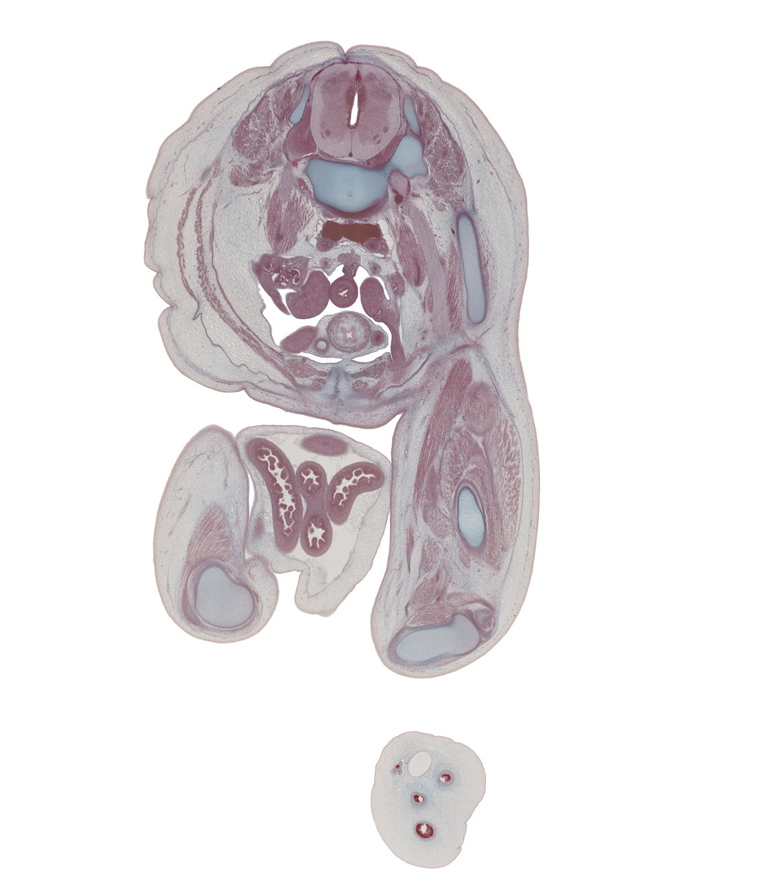 L-3 / L-4 interganglion region, adductor magnus muscle, caudal edge of jejunum loop, caudal edge of testis, external abdominal oblique muscle, femoral nerve, femur, great saphenous vein, gubernaculum of testis, head of fibula, herniated intestines, inferior epigastric artery, inguinal canal, internal abdominal oblique muscle, junction of common iliac veins, lateral condyle of tibia, medial condyle of tibia, rectus femoris muscle, sartorius muscle, semimembranosus muscle, semitendinosus tendon, superficial inguinal ring, symphysis of pubis, transversus abdominis muscle, umbilical coelom, umbilical cord, ureter, urinary bladder lumen, vas deferens, vastus intermedius muscle, vastus lateralis muscle