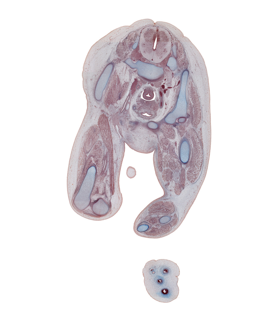 L-5 spinal ganglion, L-5 spinal nerve, biceps femoris muscle, caudal edge of umbilical cord, common iliac artery, extensor digitorum longus muscle, external iliac artery, femur, fibula, fibularis longus muscle, flexor digitorum longus muscle, gluteus maximus muscle, gracilis muscle, gubernaculum of testis, head of femur, iliac crest, iliacus muscle, iliocostalis muscle, ilium, interosseus ligament, junction of rectum and sigmoid colon, multifidus muscle, paramesonephric duct, pectineus muscle, plantaris tendon, pubis, sciatic nerve, semimembranosus muscle, semitendinosus muscle, tibia, tibial nerve, tibialis anterior muscle, triceps surae muscle, ureter, vas deferens (mesonephric duct)