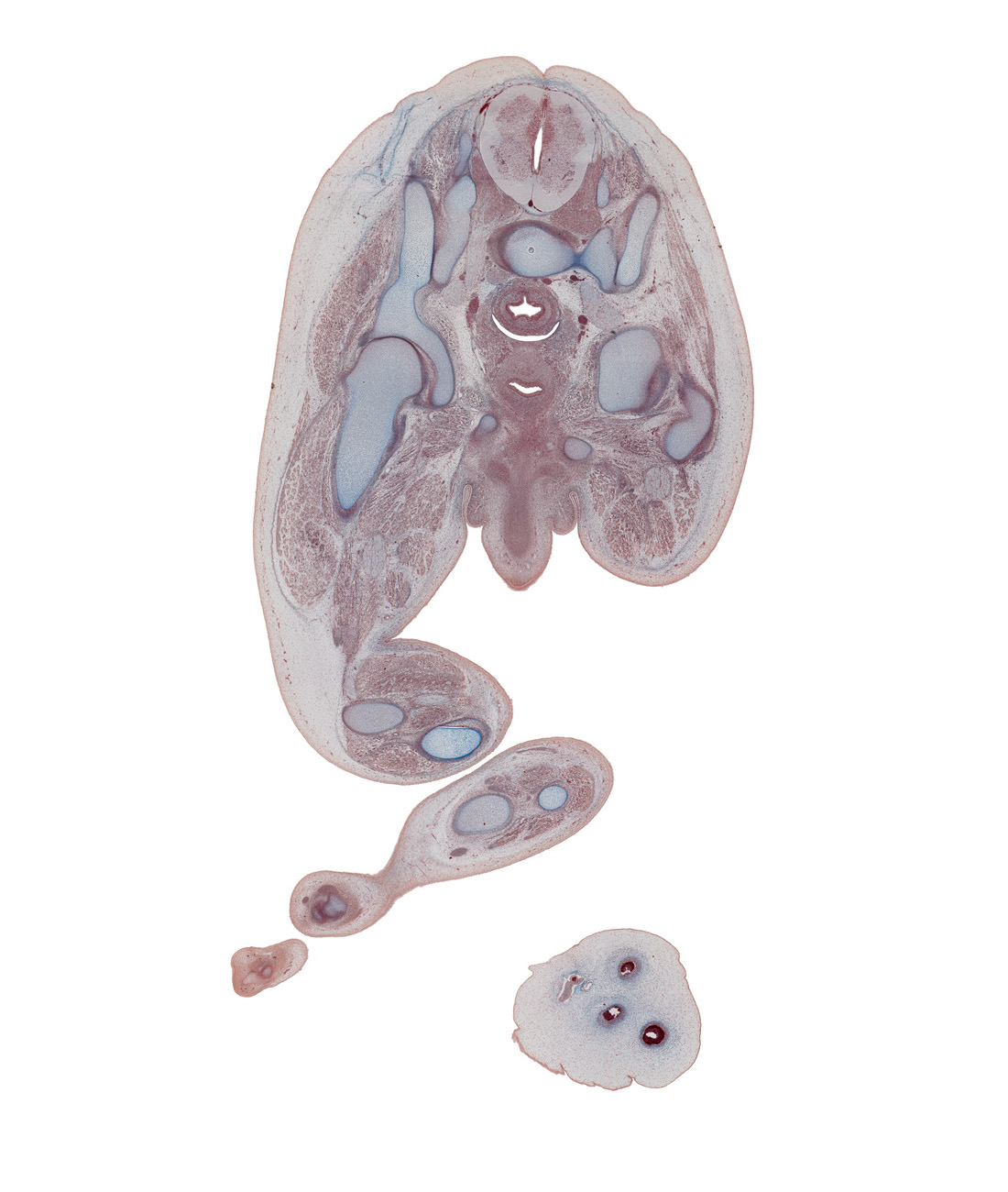 S-1 spinal ganglion, acetabular fossa, calcaneal tendon, caudal edge of rectovesicle pouch, corpus cavernosum, crus of penis, distal phalynx of digit 2 (foot), extensor digitorum longus muscle, extensor hallucis longus muscle, fibula, fibularis longus and fibularis brevis muscles, flexor digitorum longus tendon, flexor hallucis longus muscle, gluteus medius muscle, gubernaculum of testis, ischiopubic ramus, notochord, penis, proximal phalynx of digit 1 (foot), rectum, sacral plexus, sacro-iliac joint, sciatic nerve, scrotal swelling, tibia, tibialis anterior tendon, tibialis posterior tendon, urinary bladder trigone, vas deferens (mesonephric duct)