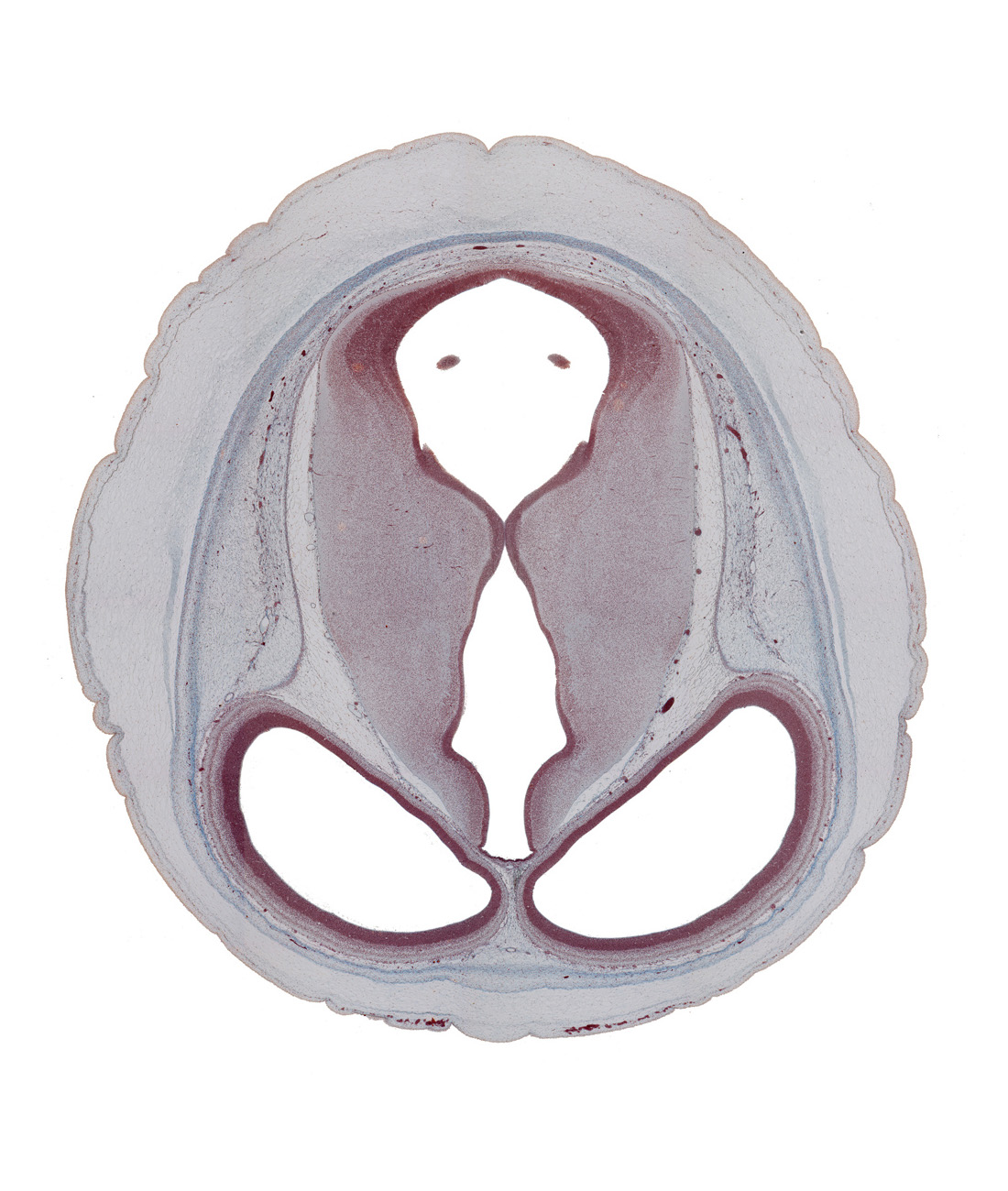 cerebral aqueduct (mesocoele), diencephalon, lateral ventricle, loose connective tissue, mesencephalon (tectum), mesencephalon (tegmentum), ossifying occipital tectum, osteogenic layer, pericranium, roof of third ventricle, sulcus dorsalis, sulcus medius, surface ectoderm, telencephalon, third ventricle