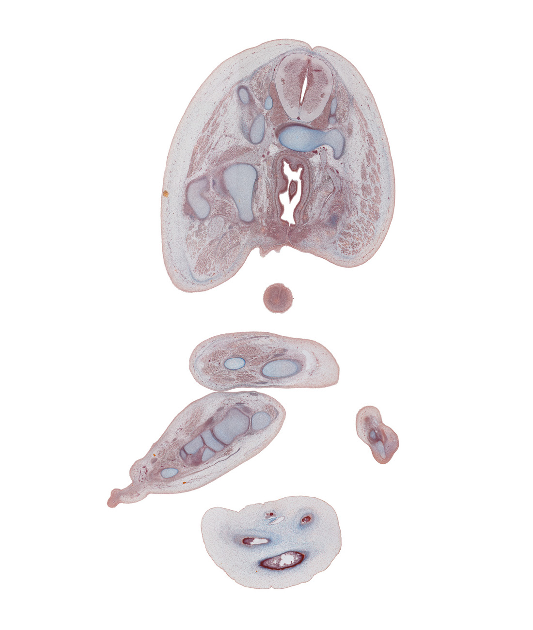 S-2 spinal ganglion, anal canal lumen, ankle joint, cuneiform 1, cuneiform 2, digit 3 (foot), extensor digitorum longus tendon, fibula, fibularis longus and fibularis brevis muscles, glans penis, gluteus maximus muscle, ilium, ischiorectal fossa, levator ani muscle, metatarsal 2, navicular, obturator internus muscle, rectum, right foot, right leg, sacral plexus, sacrum, sympathetic trunk, talus