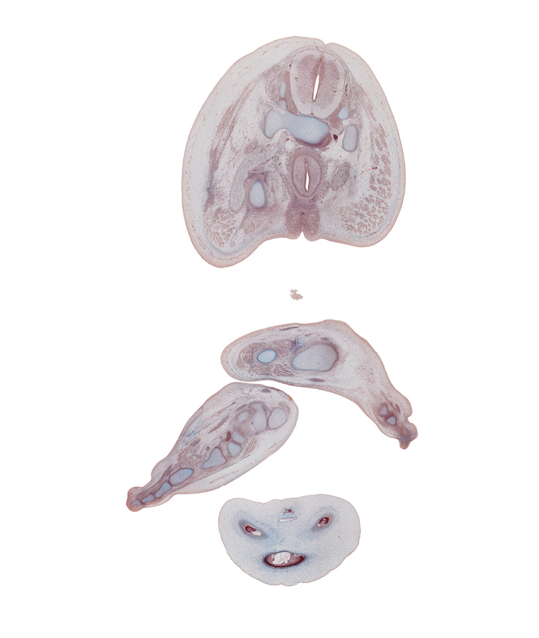 S-3 spinal ganglion, S-3 ventral primary ramus, anal canal, anorectal junction, anus, calcaneal tendon, calcaneum, caudal edge of glans penis, caudal part of rectum, cuneiform 3, digit 3 (foot), extensor digitorum brevis muscle, fibularis longus and fibularis brevis tendons, flexor digitorum longus tendon, gluteus maximus muscle, ischiorectal fossa, lateral malleolus of fibula, levator ani muscle, metatarsal 3, navicular, plantar surface of foot, proximal phalynx of digit 3 (foot), right foot, sacrum, sympathetic trunk, talus