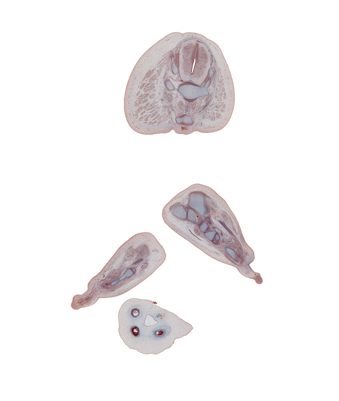 S-4 / S-5 interganglion region, calcaneum, coccyx, digit 4 (foot), flexor digitorum brevis muscle, ganglion impar, gluteus maximus muscle, metatarsal 5, plantar aponeurosis, plantar surface of left foot, right foot, sacrum, sympathetic trunk