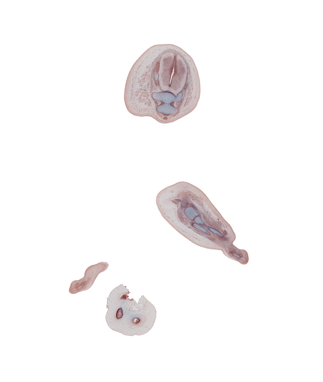 Co-1 spinal ganglion, Co-1 spinal nerve, coccyx, edge of digit 5 (foot), gluteus maximus muscle, plantar surface of right foot