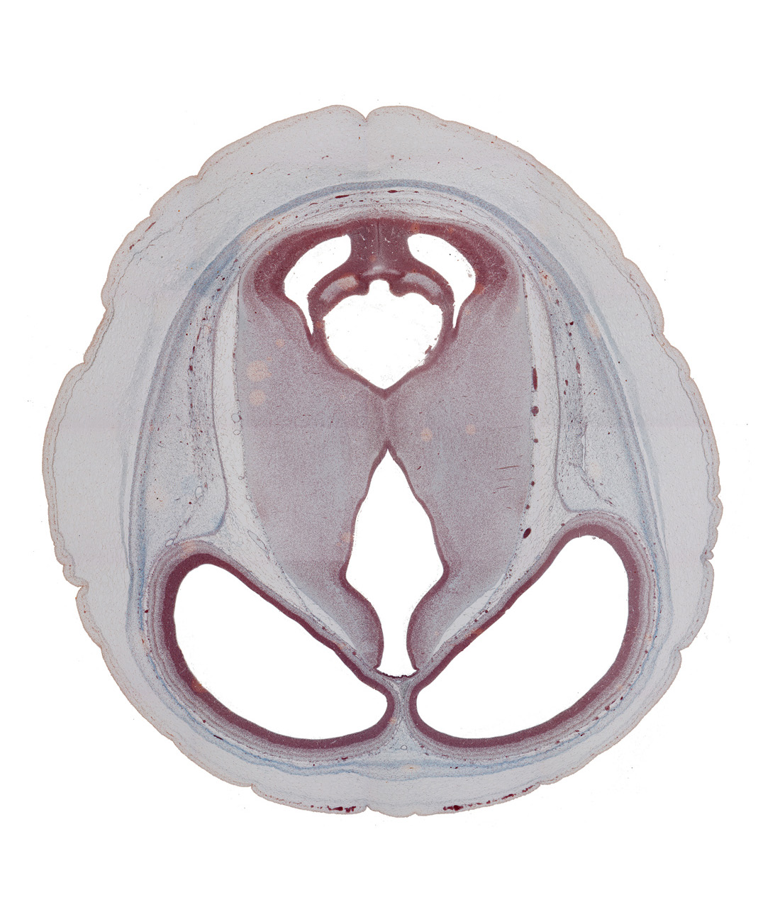 blind sack of cerebral aqueduct, cerebral aqueduct (mesocoele), cerebral hemisphere, diencephalon, dorsal thalamus, hypothalamic sulcus, inferior colliculus, lateral ventricle, mesencephalon (tectum), mesencephalon (tegmentum), sensory decussation, subarachnoid space, subcutaneous vascular plexus, sulcus dorsalis, third ventricle, vessels in pia mater