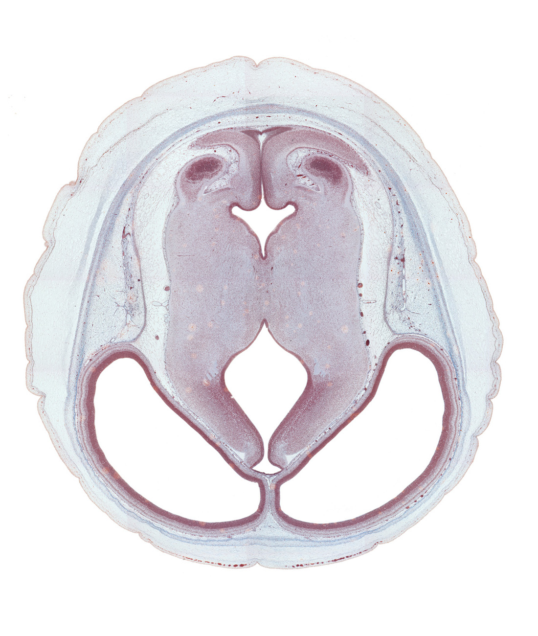 basis pedunculi of pons region (metencephalon), caudal edge of inferior colliculus, caudal part of cerebral aqueduct, cephalic part of cerebellum, cephalic part of rhombencoel (fourth ventricle), diencephalic artery, dorsal thalamus, hypothalamic sulcus, isthmus of rhombencephalon, lateral ventricle, median sulcus, mesencephalic artery, mesencephalon, root of trochlear nerve (CN IV), sensory decussation, subcutaneous vascular plexus, sulcus dorsalis, sulcus limitans, ventral thalamus