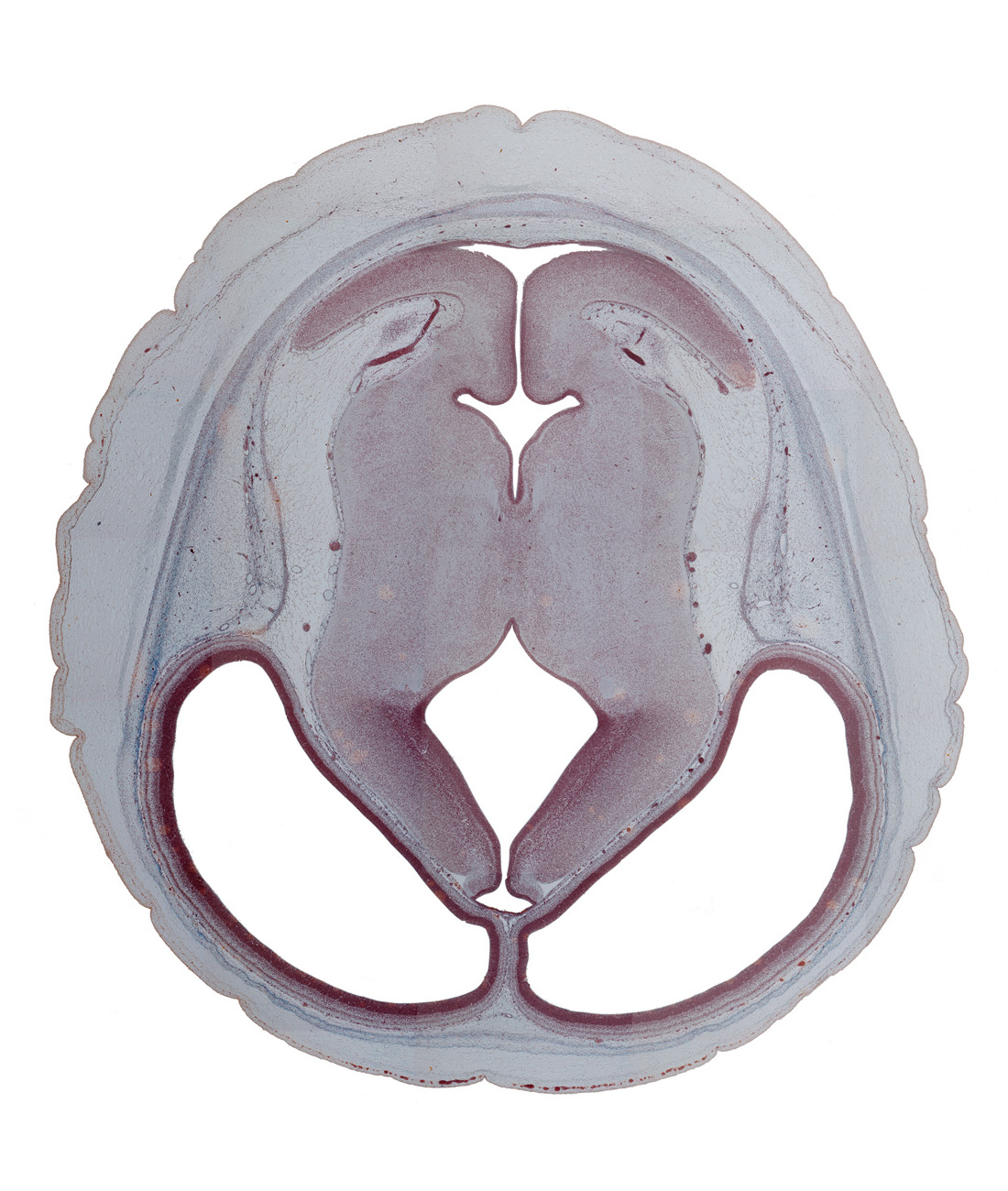 cerebellum, cerebral aqueduct (mesocoele), cerebral hemisphere, dorsal thalamus, epidermis, lateral ventricle, median sulcus, rhombencoel (fourth ventricle), subarachnoid space, subcutaneous tissue, third ventricle