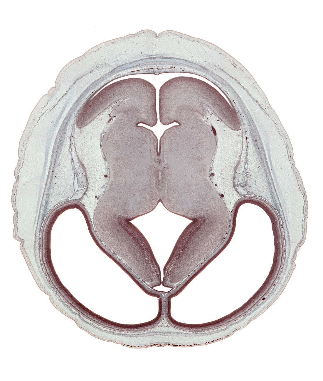 alar plate(s), cerebral hemisphere, dorsal thalamus, dural venous sinus, external germinal area, flocculus of cerebellum, hypothalamic sulcus, isthmus of rhombencephalon, lateral ventricle, median sulcus, membrane area of roof of rhombencoel (fourth ventricle), parietal lobe region, rhombencoel (fourth ventricle), roof of diencephalon, sensory decussation, subarachnoid space, subcutaneous tissue, sulcus dorsalis, third ventricle