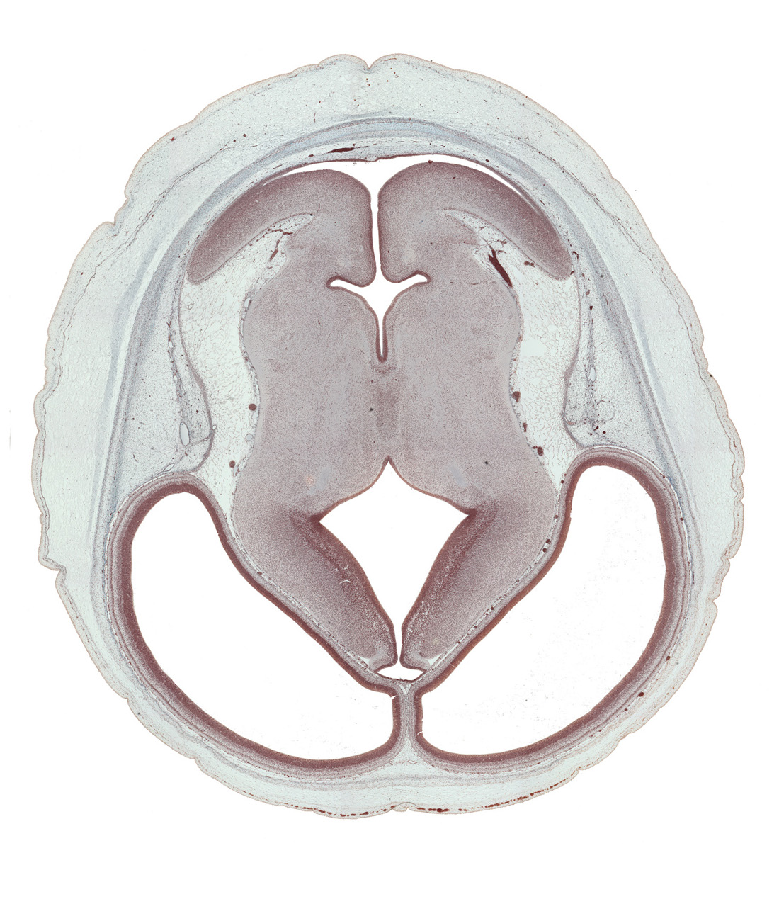 basis pedunculi of pons region (metencephalon), cerebral aqueduct (mesocoele), cerebral hemisphere (neopallium), cortical plate, diencephalic artery, dorsal thalamus, hypothalamic sulcus, intraventricular cerebellum, junction of cerebral aqueduct and rhombencoel (fourth ventricle), median sulcus, mesencephalic artery, rhombencoel (fourth ventricle), roof of third ventricle, sensory decussation, sulcus dorsalis, sulcus medius, superior cerebellar artery, trochlear nerve (CN IV), ventral thalamus