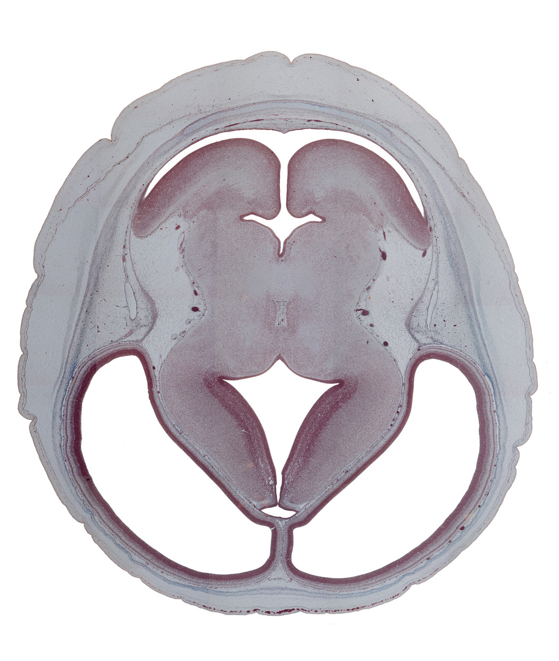basis pedunculi of pons region (metencephalon), cerebral aqueduct (mesocoele), cerebral hemisphere, dorsal thalamus, hypothalamic sulcus, internal fiber layer (cerebellum), lateral ventricle, median sulcus, mesencephalic artery, rhombencoel (fourth ventricle), subarachnoid space, superior cerebellar artery, superior sagittal sinus, third ventricle