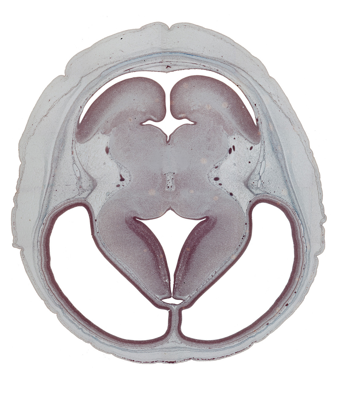 basis pedunculi of pons region (metencephalon), cerebral hemisphere, dorsal thalamus, dural venous sinus, hypothalamic sulcus, internal fiber layer (cerebellum), interpeduncular fossa, lateral ventricle, median sulcus, membrane area of roof of rhombencoel (fourth ventricle), mesencephalic artery, osteogenic layer, rhombencoel (fourth ventricle), subarachnoid space, superior cerebellar artery, superior sagittal sinus, trochlear nerve (CN IV), ventral thalamus