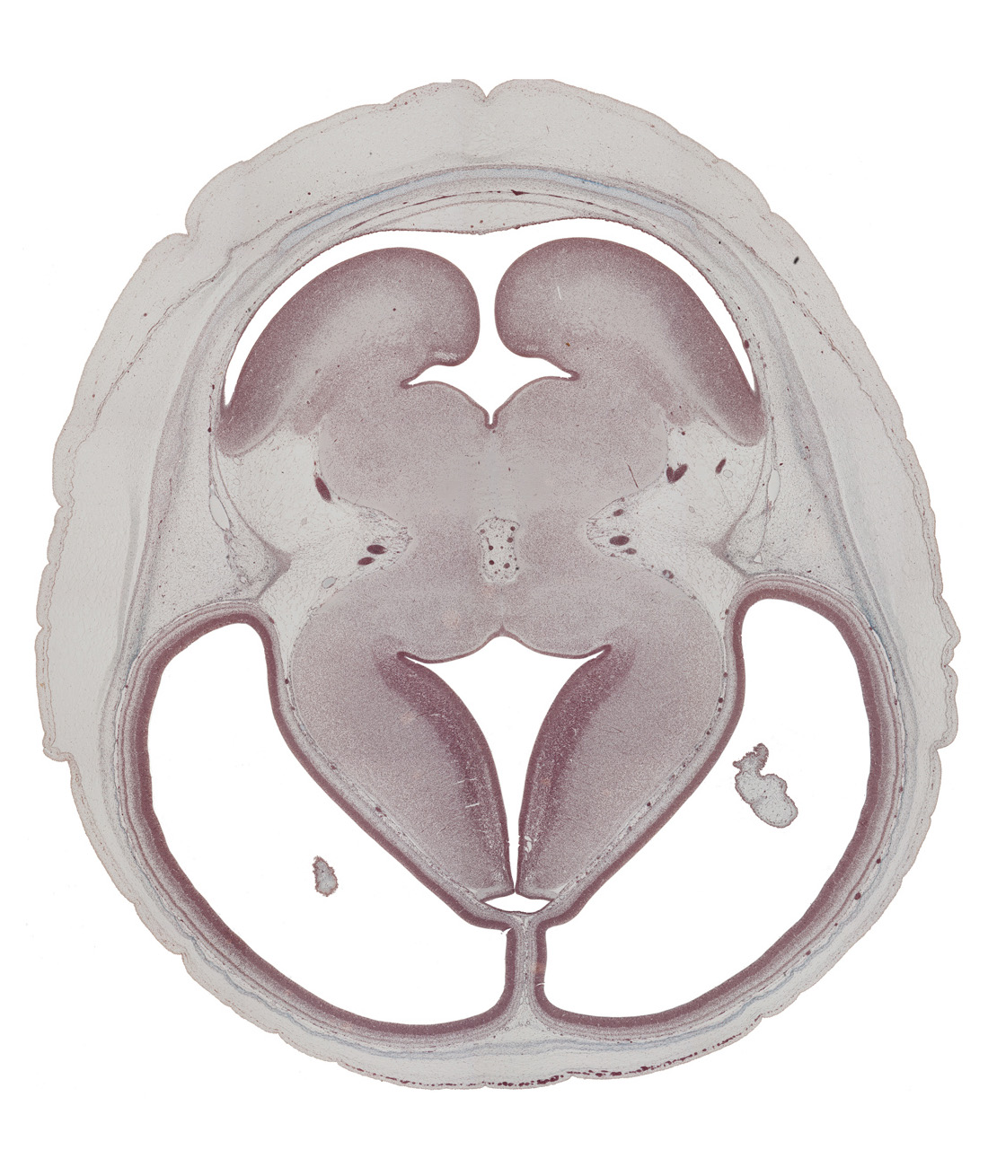 alar plate(s), basal plate, basis pedunculi of pons region (metencephalon), dorsal thalamus, edge of choroid plexus, hypothalamic sulcus, internal cerebellar swelling, interpeduncular fossa, median sulcus, membrane area of roof of rhombencoel (fourth ventricle), parietal lobe region of cerebral hemisphere, roof of third ventricle, sulcus dorsalis, sulcus limitans, supra-occipital cartilage, temporal lobe region of cerebral hemisphere, trochlear nerve (CN IV), ventral thalamus