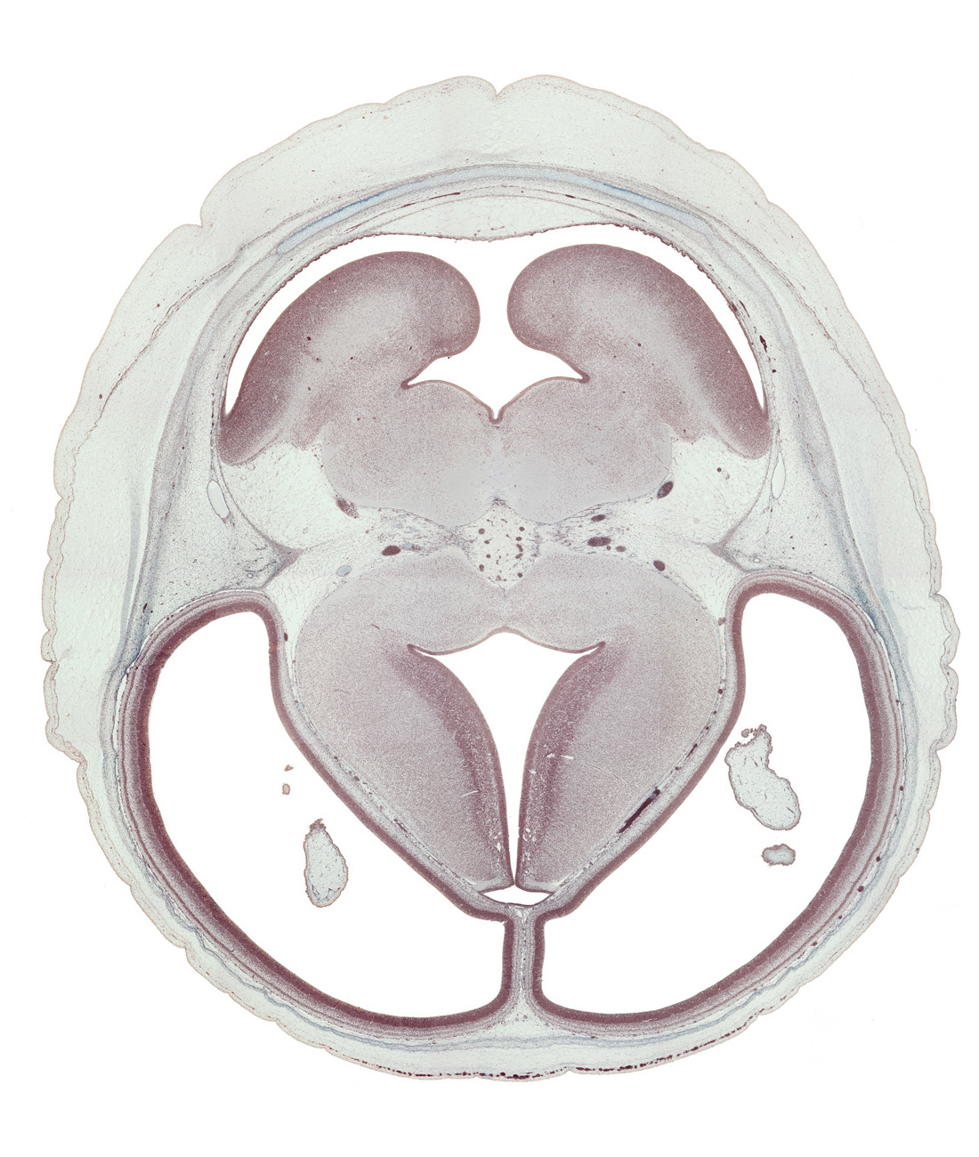 alar plate(s), basal plate, basis pedunculi of pons region (metencephalon), dorsal thalamus, dural limiting layer, hypothalamic sulcus, interpeduncular fossa, lateral ventricle, medial wall of cerebral hemisphere, mesencephalic artery, origin of oculomotor nerve (CN III), osteogenic layer, pyramidal tract region, rhombencoel (fourth ventricle), rhombic lip, subarachnoid space, sulcus limitans, superior cerebellar artery, third ventricle, trochlear nerve (CN IV), ventral thalamus