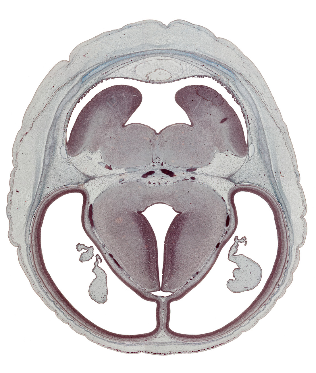 alar plate(s), basal plate, choroid plexus, cortical plate, diverticulum, dorsal thalamus, hypothalamic sulcus, intraventricular cerebellum, lateral ventricle, median sulcus, oculomotor nerve (CN III), pons region (metencephalon), posterior cerebral artery, roof of rhombencoel (fourth ventricle), subarachnoid space, sulcus dorsalis, sulcus limitans, superior cerebellar artery, superior sagittal sinus, third ventricle, trochlear nerve (CN IV), ventral thalamus