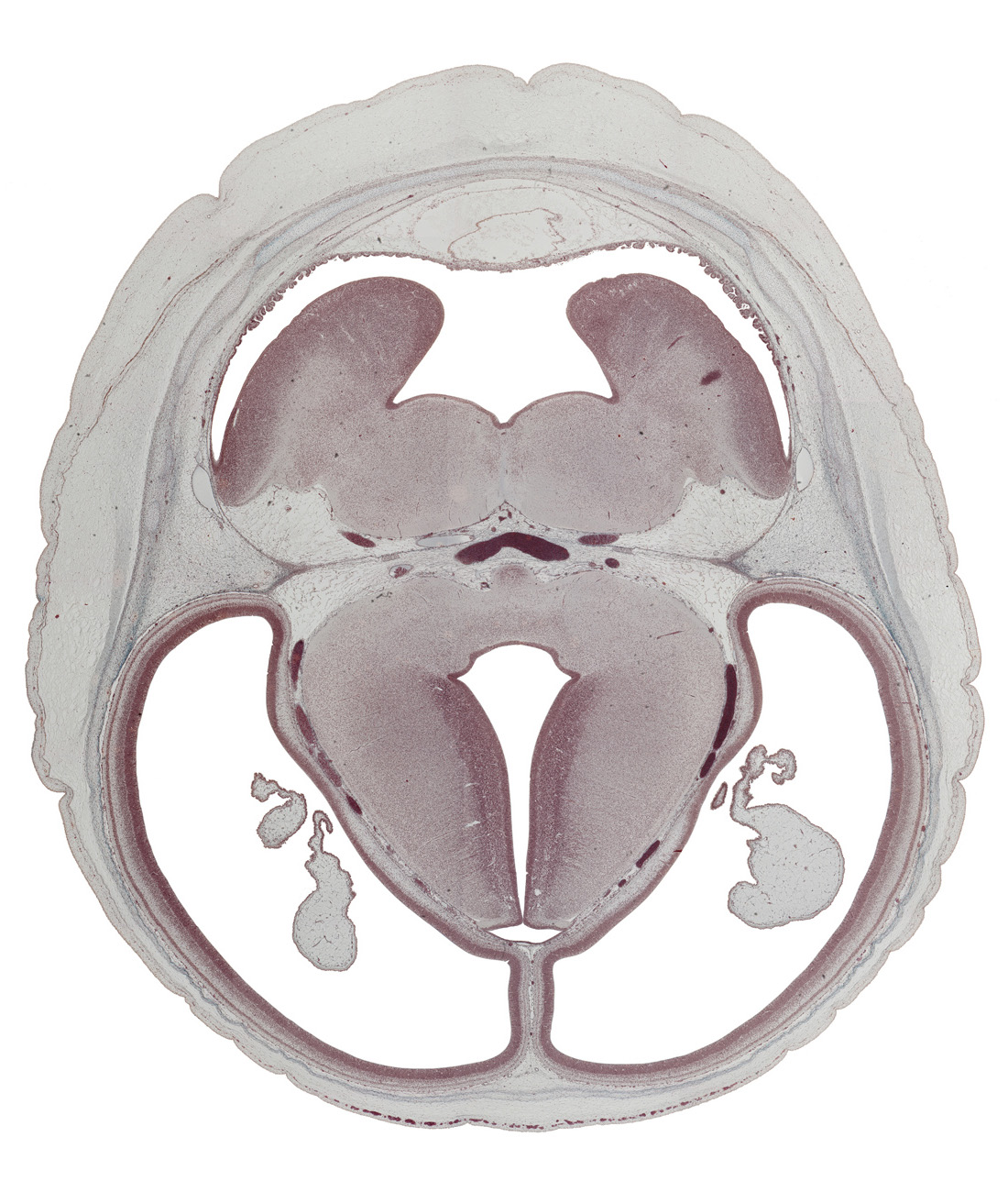 choroid plexus, cortical plate, diverticulum, hypothalamic sulcus, lateral ventricle, membrane area of roof, oculomotor nerve (CN III), pons region (metencephalon), posterior cerebral artery, pyramidal tract region, rhombencoel (fourth ventricle), superior cerebellar artery, third ventricle, trochlear nerve (CN IV)