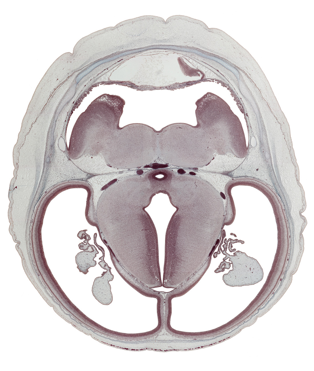 cephalic edge of medulla oblongata, choroid plexus, dorsal thalamus, hippocampus, hypothalamic sulcus, internal carotid artery, mamillary recess, oculomotor nerve (CN III), pons region (metencephalon), posterior cerebral artery, subarachnoid space, subcutaneous vascular plexus, sulcus dorsalis, terminal part of basilar artery, trochlear nerve (CN IV)