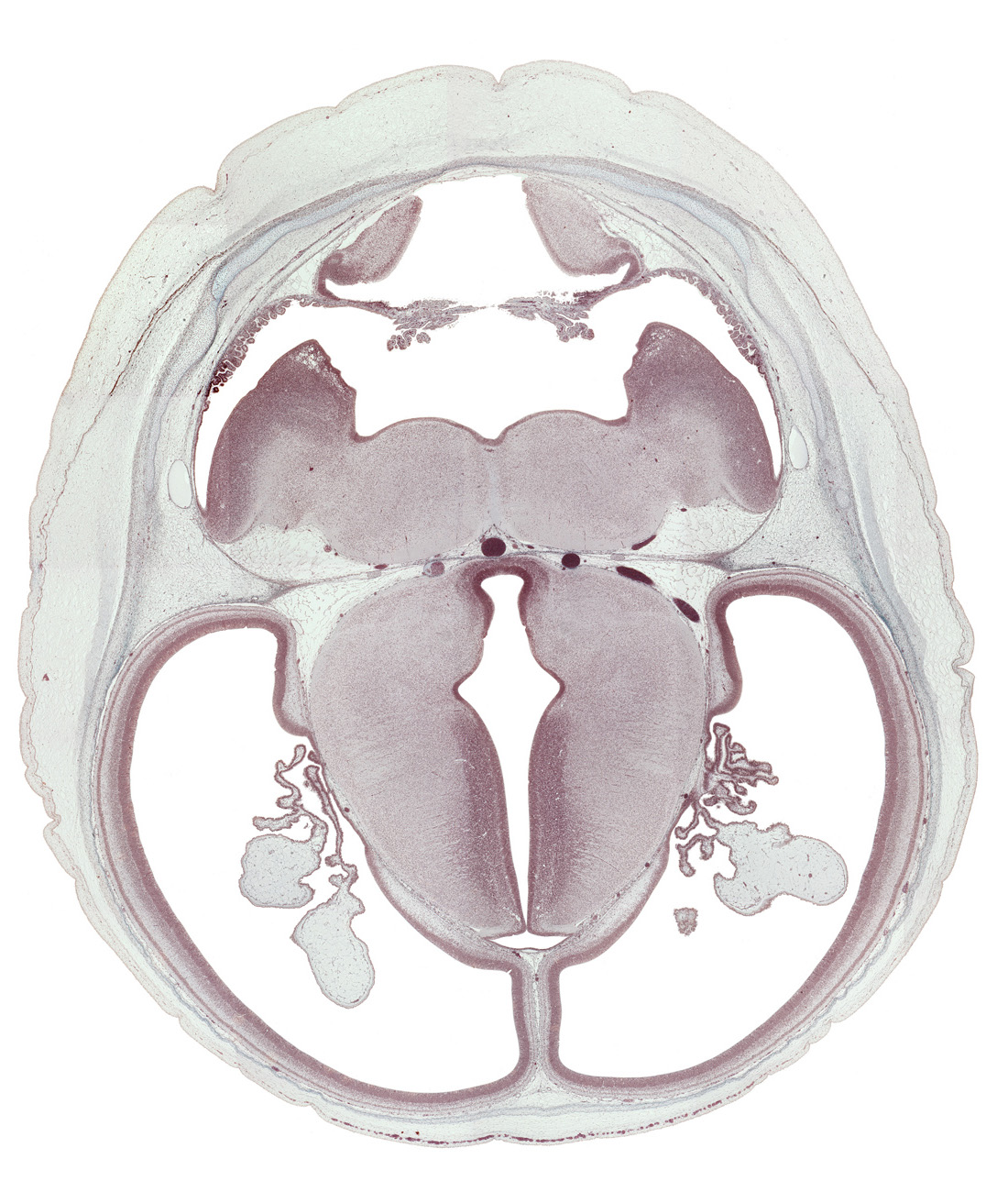 basilar artery, choroid plexus, dorsal thalamus, dural band for tentorium cerebelli, dural limiting layer, hypothalamic sulcus, hypothalamus, medulla oblongata, oculomotor nerve (CN III), posterior communicating artery, subarachnoid space, trochlear nerve (CN IV), ventral thalamus, vestibular nucleus region