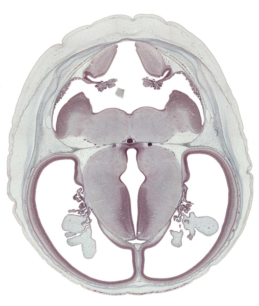 basilar artery, choroid fissure, choroid plexus, dorsal thalamus, external cerebellum, hippocampus, hypothalamic sulcus, hypothalamus, internal cerebellum, median aperture, oculomotor nerve (CN III), posterior communicating artery, rhombencoel (fourth ventricle), subthalamus, trochlear nerve (CN IV), ventral thalamus