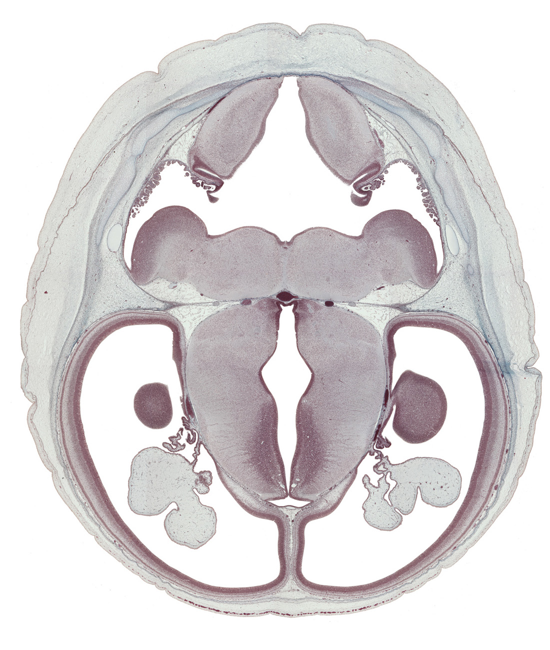 basilar artery, choroid plexus, dorsal thalamus, dural band for tentorium cerebelli, edge of ventricular eminence(s), hypothalamic sulcus, hypothalamus, oculomotor nerve (CN III), rhombencoel (fourth ventricle), sulcus dorsalis, trochlear nerve (CN IV), ventral thalamus
