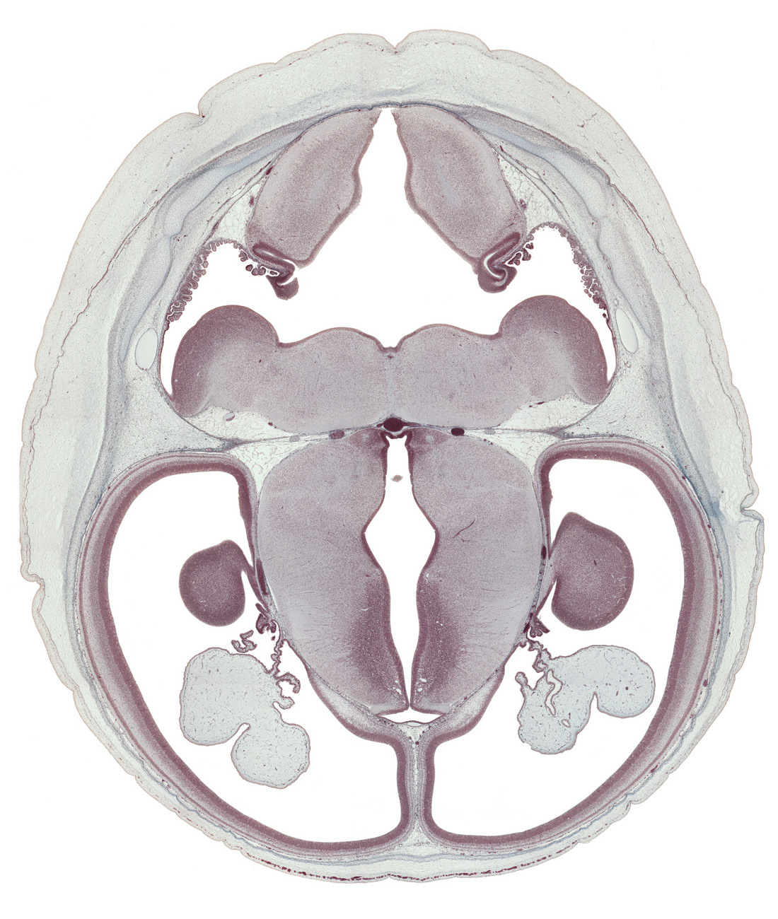 anterior choroidal artery, basilar artery, choroid plexus, dorsal thalamus, hippocampus, hypothalamic sulcus, hypothalamus, inferior sagittal sinus, intermediate zone, lateral ventricle, lateral ventricular eminence (telencephalon), marginal ridge, marginal zone, medial ventricular eminence (diencephalon), medulla oblongata, oculomotor nerve (CN III), posterior communicating artery, roof of rhombencoel (fourth ventricle), sulcus limitans, trochlear nerve (CN IV), ventricular zone, vestibular nucleus region
