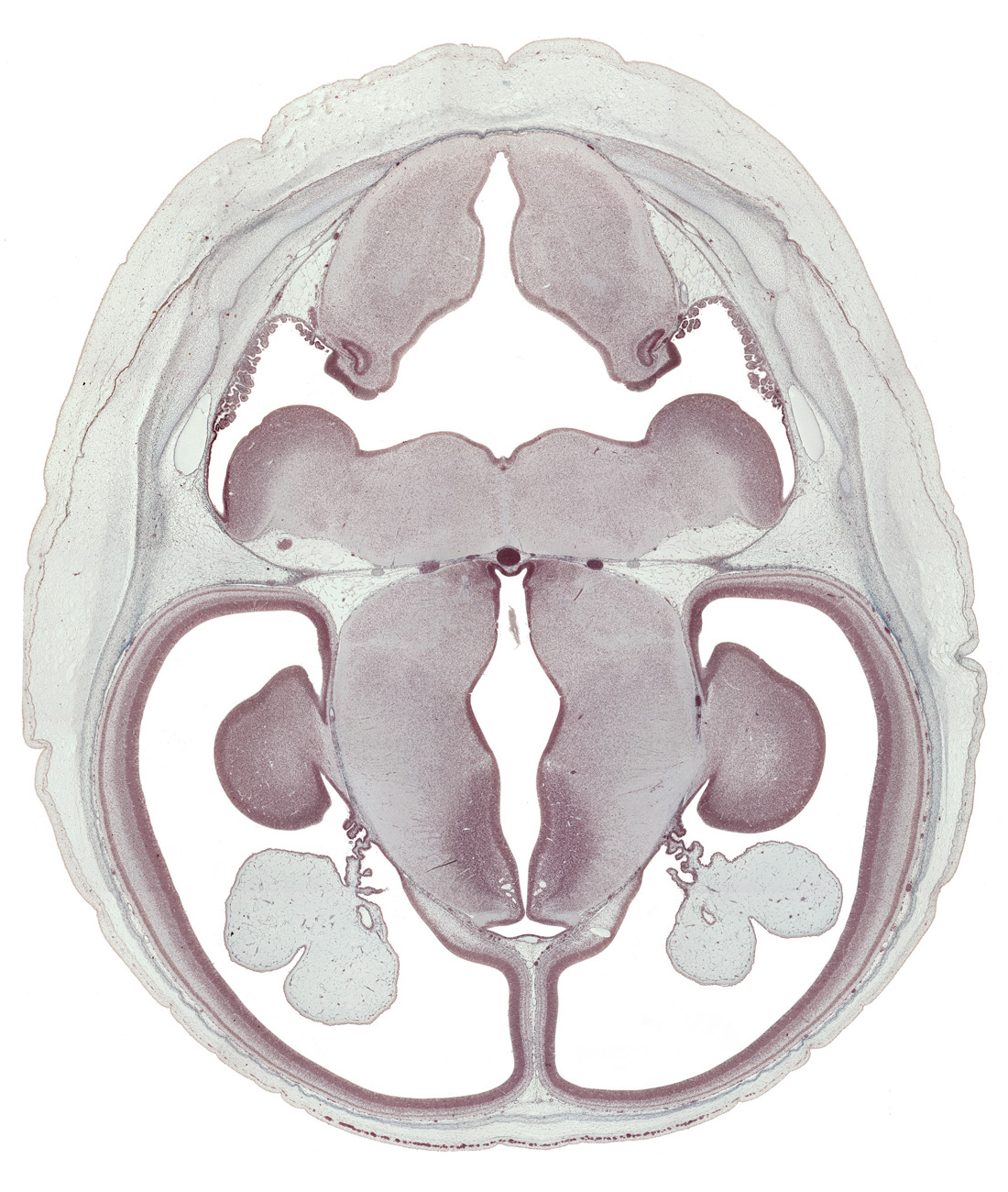 alar plate(s), basal plate, basis pedunculi of pons region (metencephalon), external cerebellum, falx cerebri region, fusion region with anterior choroidal artery, hypothalamic sulcus, hypothalamus, inferior sagittal sinus, internal capsule, internal cerebellum, median sulcus, medulla oblongata, parietal lobe region of cerebral hemisphere, roof of rhombencoel (fourth ventricle), roof plate, subthalamus, sulcus limitans, sulcus medius, superior sagittal sinus, tegmentum of pons, temporal lobe region of cerebral hemisphere, third ventricle