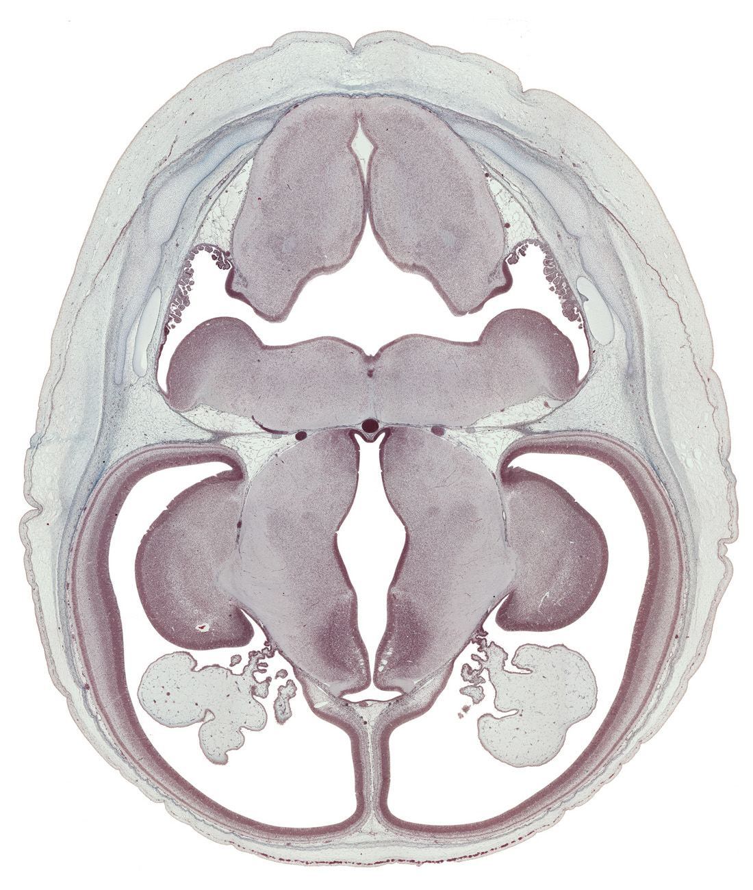 abducens nucleus, basilar artery, caudate nucleus, choroid plexus, dorsal thalamus, fusion region between cerebral vesicle and diencephalon, hypoglossal nucleus, hypothalamus, lateral ventricle, marginal ridge, medulla oblongata, obex, oculomotor nerve (CN III), pons region (metencephalon), rhombencoel (fourth ventricle), sensory decussation, spinal tract of trigeminal nerve (CN V), sulcus dorsalis, sulcus medius, third ventricle, trochlear nerve (CN IV), ventral thalamus