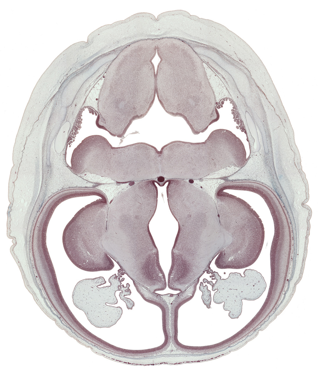 alar plate(s), anterior inferior cerebellar artery, basilar artery, choroid plexus, dorsal thalamus, hypothalamic sulcus, hypothalamus, inferior horn of lateral ventricle, internal capsule, lateral recess of rhombencoel (fourth ventricle), marginal ridge, obex, posterior communicating artery, posterior inferior cerebellar artery, rhombencoel (fourth ventricle), sulcus dorsalis, sulcus medius, third ventricle, ventral thalamus, zona limitans intrathalamica