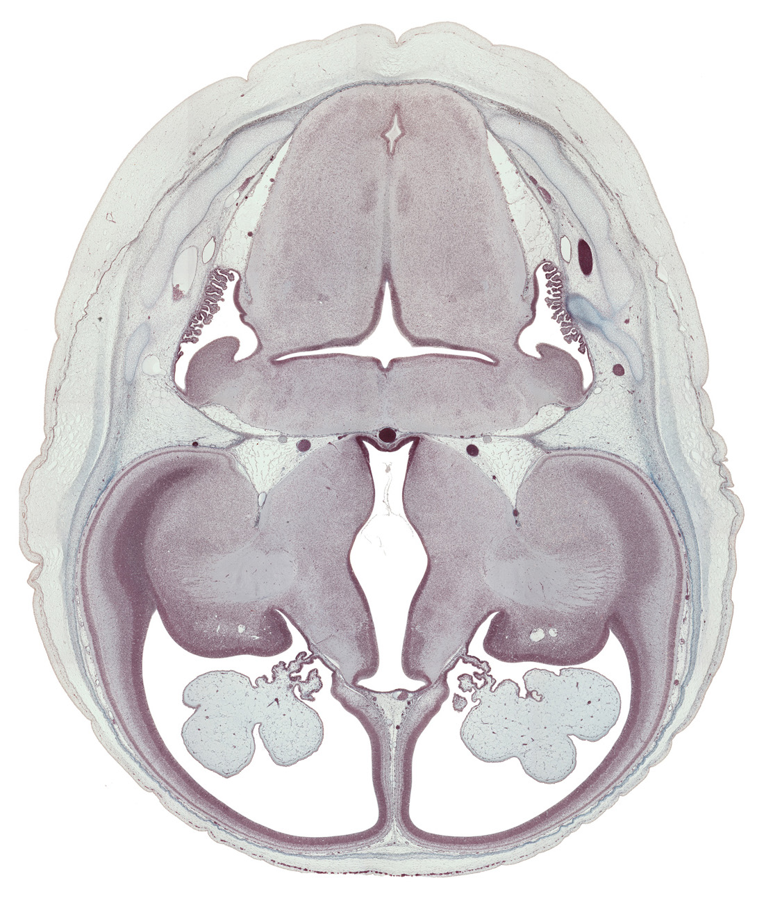 basilar artery, caudate nucleus, cephalic edge of dorsal thalamus, choroid plexus, cortical plate, edge of otic capsule, endolymphatic sac, fusion region with anterior choroidal artery, internal capsule, lateral recess of rhombencoel (fourth ventricle), lateral ventricular eminence (telencephalon), medial ventricular eminence (diencephalon), oculomotor nerve (CN III), posterior communicating artery, rhombencoel (fourth ventricle), supra-occipital cartilage, tegmentum of pons, trochlear nerve (CN IV)