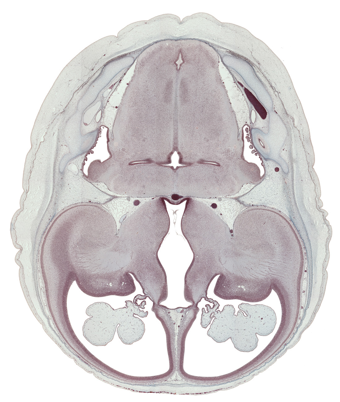 caudate nucleus, choroid fissure, choroid plexus, claustrum, dural band for tentorium cerebelli, endolymphatic sac, globus pallidus, hippocampus, hypothalamic sulcus, hypothalamus, internal capsule, lamina affixa, lateral recess of rhombencoel (fourth ventricle), lateral ventricle, lateral ventricular eminence (telencephalon), medial accessory olivary nucleus, medial ventricular eminence (diencephalon), putamen, rhombencoel (fourth ventricle), spinal tract of trigeminal nerve (CN V), sulcus terminalis, third ventricle, transverse sinus