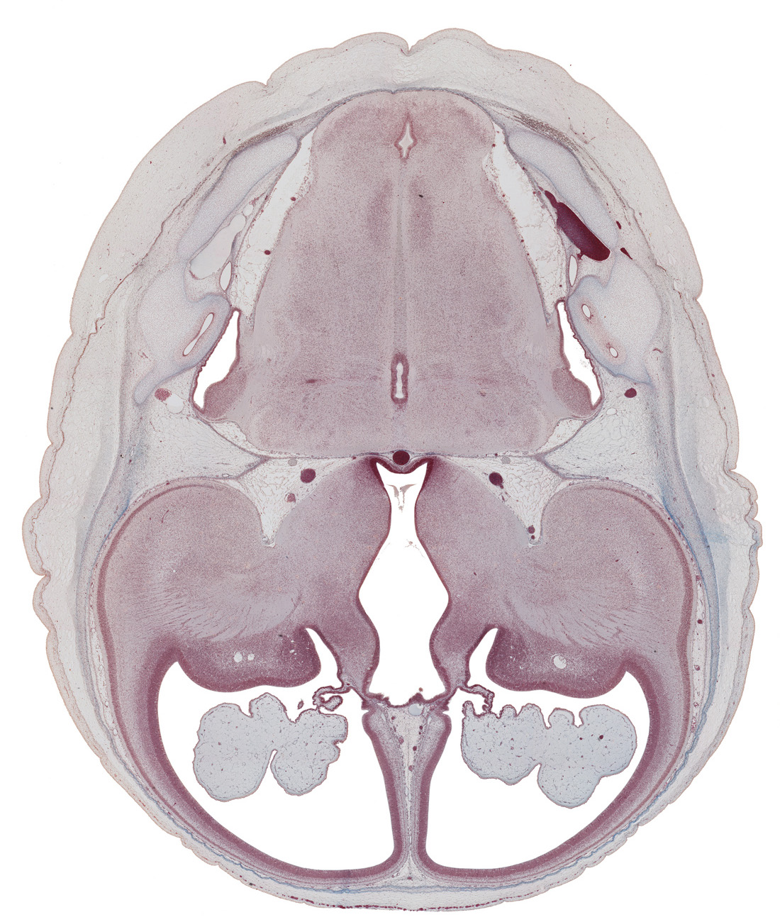 anterior choroidal artery, capsula extrema, caudate nucleus, claustrum, cortical plate, edge of anterior semicircular duct, edge of median sulcus in floor of rhombencoel (fourth ventricle), endolymphatic sac, external capsule, falx cerebri region, fasciculus cuneatus, fasciculus gracilis, globus pallidus, interventricular foramen, lateral recess of rhombencoel (fourth ventricle), medial accessory olivary nucleus, medial lemniscus, medulla oblongata, nucleus of spinal tract of trigeminal nerve, oculomotor nerve (CN III), petrous part of temporal bone (otic capsule), posterior communicating artery, putamen, sulcus terminalis, superior sagittal sinus, third ventricle, trochlear nerve (CN IV)