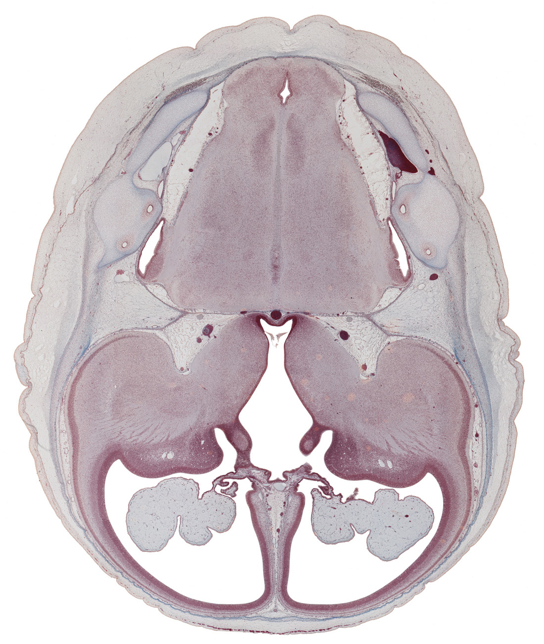 anterior inferior cerebellar artery, anterior semicircular duct, basilar artery, central canal, choroid fissure, edge of interventricular foramen, hypothalamic sulcus, hypothalamus, insula of cerebral hemisphere, lateral recess of rhombencoel (fourth ventricle), lateral ventricle, lateral ventricular eminence (telencephalon), medial accessory olivary nucleus, medial lemniscus, medial ventricular eminence (diencephalon), medulla oblongata, posterior communicating artery, posterior inferior cerebellar artery, sigmoid sinus, subarachnoid space, sulcus terminalis, third ventricle
