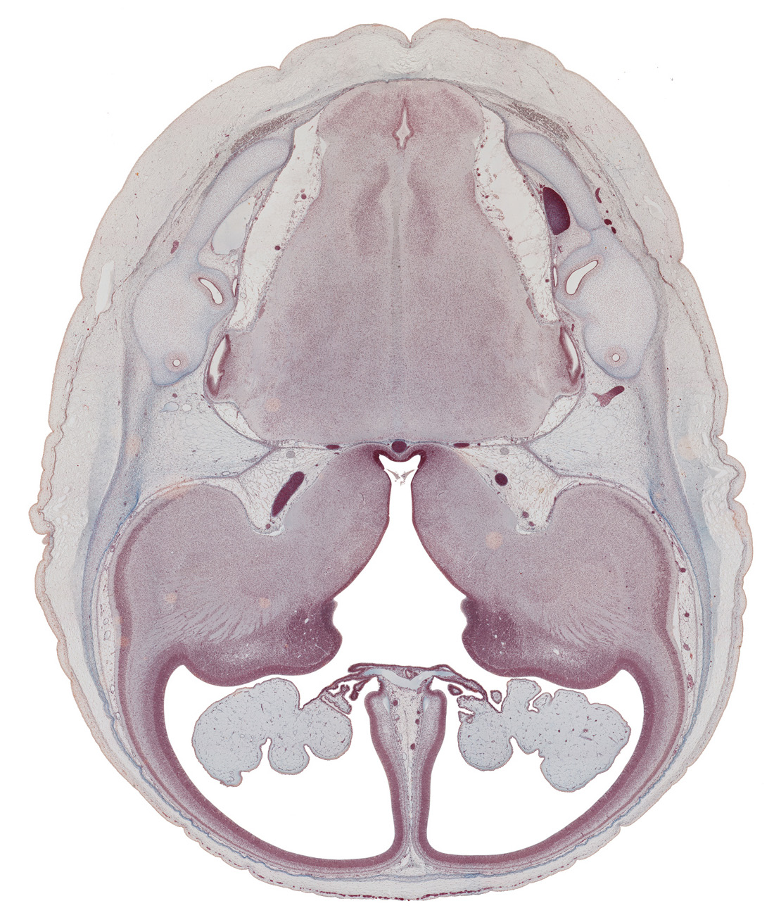 anterior semicircular duct, central canal, choroid fissure, choroid plexus, common limb of semicircular duct, cortical plate, decussation, edge of lateral recess of rhombencoel (fourth ventricle), endolymphatic duct, exoccipital, falx cerebri region, internal capsule, interventricular foramen, lateral ventricular eminence (telencephalon), medial accessory olivary nucleus, medial ventricular eminence (diencephalon), oculomotor nerve (CN III), pons region (metencephalon), pyramidal tract region, root of cranial accessory nerve (CN XI), root of vagus nerve (CN X), third ventricle, trochlear nerve (CN IV)