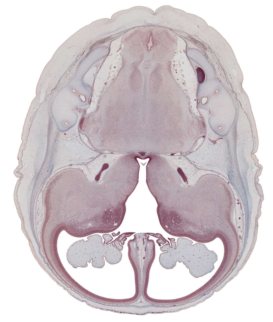 anterior semicircular duct, caudate nucleus, central canal, choroid plexus, common limb of semicircular duct, falx cerebri region, hippocampus, insula of cerebral hemisphere, internal carotid artery, interventricular foramen, lateral ventricle, medial accessory olivary nucleus, middle cerebral artery, posterior semicircular duct, pyramidal tract region, root of cranial accessory nerve (CN XI), root of glossopharyngeal nerve (CN IX), root of trigeminal nerve (CN V), root of vagus nerve (CN X), roots of vagus and cranial accessory nerves (CN X and CN XI), semispinalis capitis muscle, spinal tract of trigeminal nerve (CN V), third ventricle