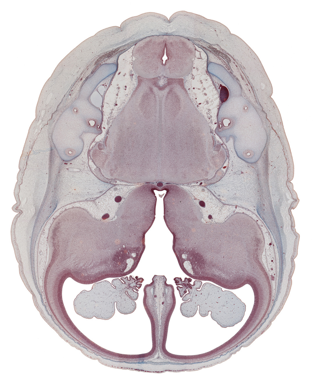 anterior inferior cerebellar artery, anterior semicircular duct, basilar artery, common limb of semicircular duct, cortical plate, decussation, endolymphatic duct, falx cerebri region, insula of cerebral hemisphere, internal carotid artery, lateral ventricle, lateral ventricular eminence (telencephalon), medial ventricular eminence (diencephalon), nucleus cuneatus, nucleus gracilis, nucleus of spinal tract of trigeminal nerve, oculomotor nerve (CN III), optic tract, pons region (metencephalon), posterior inferior cerebellar artery, posterior semicircular duct, pyramidal tract region, root of cranial accessory nerve (CN XI), root of glossopharyngeal nerve (CN IX), root of vagus nerve (CN X), subarachnoid space, third ventricle, trochlear nerve (CN IV)