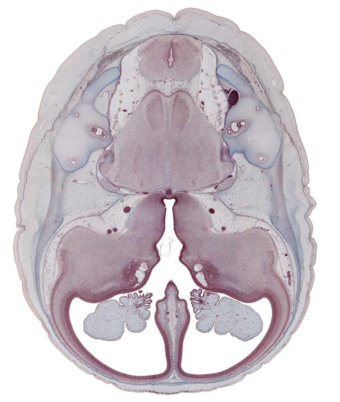 anterior semicircular duct, choroid plexus, common limb of semicircular duct, dural band for tentorium cerebelli, fasciculus cuneatus, fasciculus gracilis, hippocampus, interventricular foramen, lateral ventricle, medial accessory olivary nucleus, optic groove, origin of facial nerve (CN VII), origin of hypoglossal nerve (CN XII), origin of vestibulocochlear nerve (CN VIII), pons region (metencephalon), posterior semicircular duct, pyramidal tract region, region of cervical flexure, root of trigeminal nerve (CN V), sigmoid sinus, spinal tract of trigeminal nerve (CN V), third ventricle