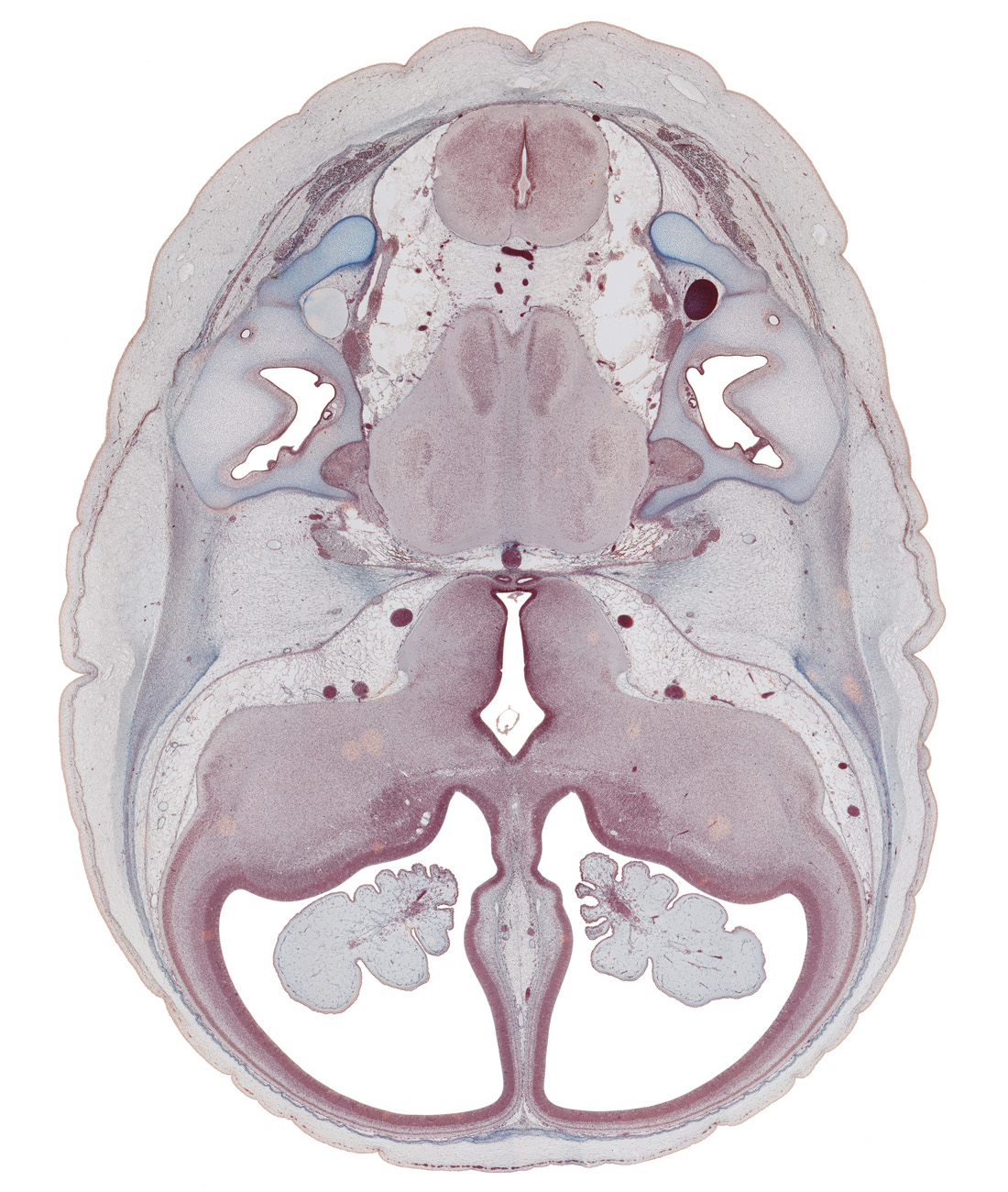 accessory nerve (CN XI), alar plate(s), anterior commissure region, basal plate, basilar artery, central canal, decussation, endolymphatic duct, glossopharyngeal nerve (CN IX), hippocampus, hypothalamus, insula of cerebral hemisphere, internal carotid artery, jugular foramen, junction of anterior semicircular duct and utricle, lateral ventricular eminence (telencephalon), medial ventricular eminence (diencephalon), medulla oblongata, middle cerebral artery, oculomotor nerve (CN III), optic groove, posterior semicircular duct, region of cervical flexure, root of trigeminal nerve (CN V), sulcus limitans, trochlear nerve (CN IV), tuberal part of adenohypophysis, utricle, vagus nerve (CN X), vestibulocochlear nerve (CN VIII)